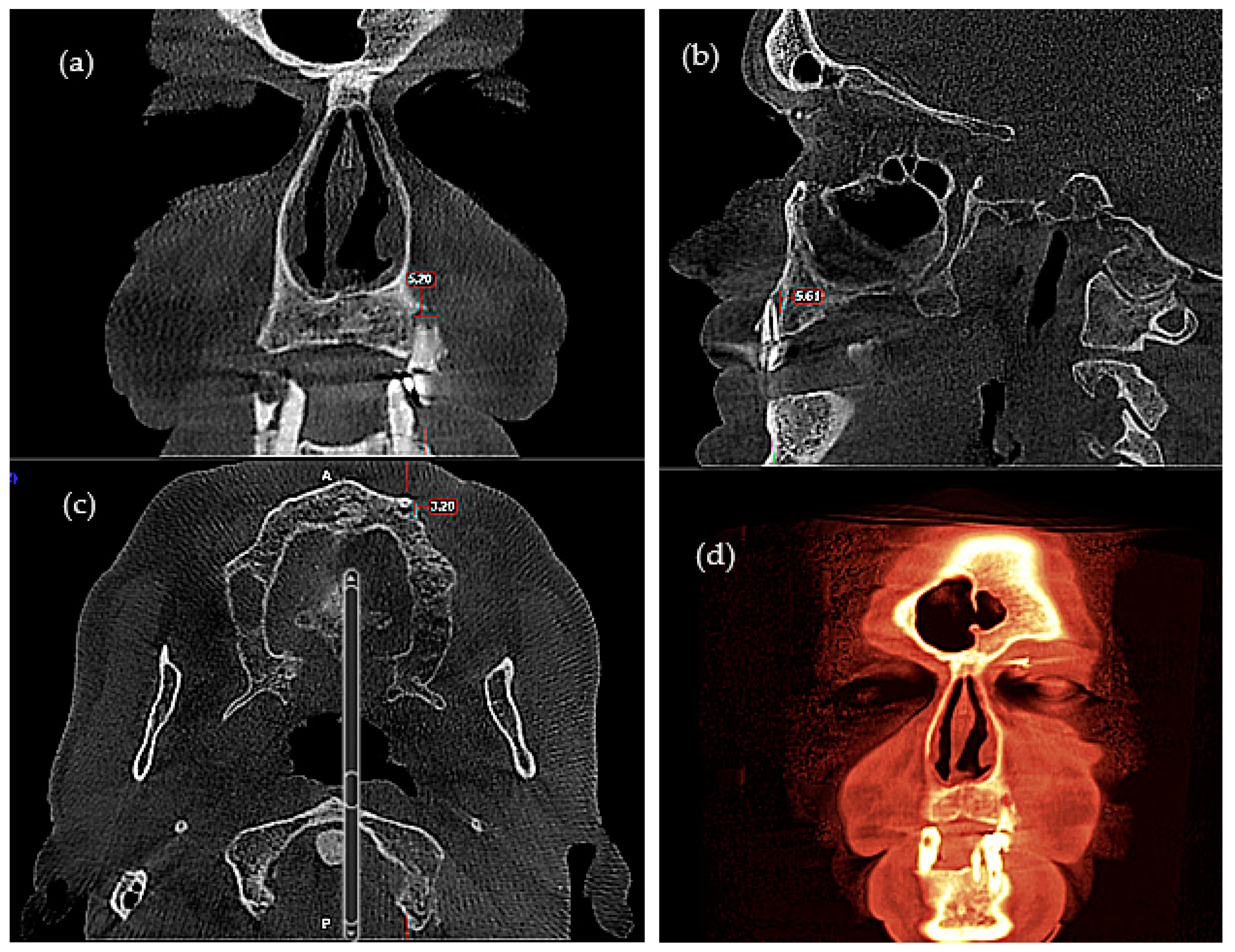 Applsci 12 05235 g002