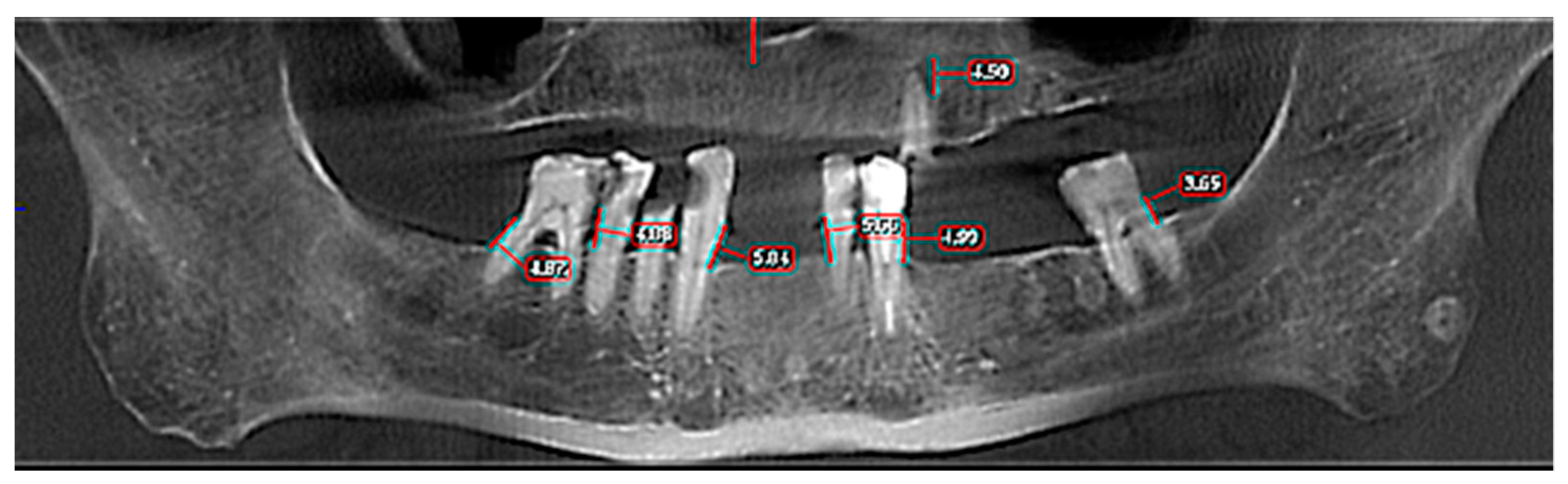 Applsci 12 05235 g003