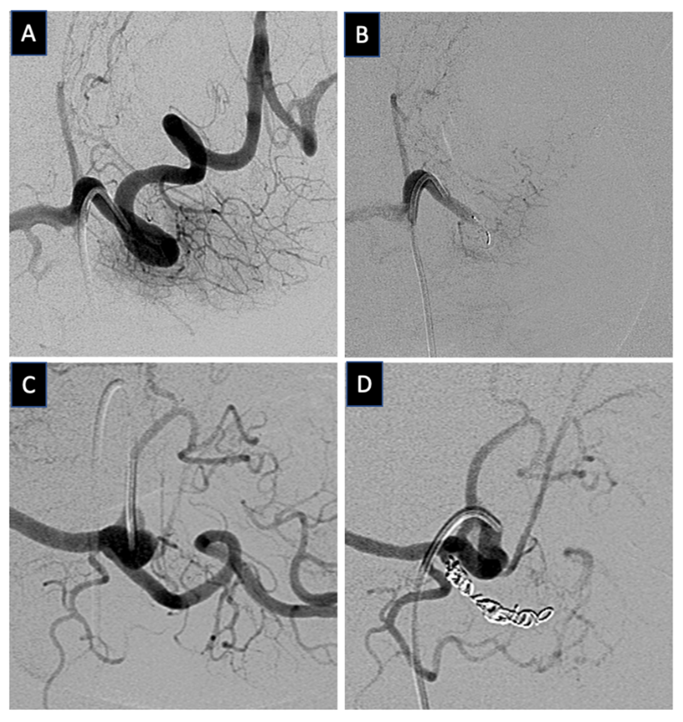 Applsci 12 05262 g001