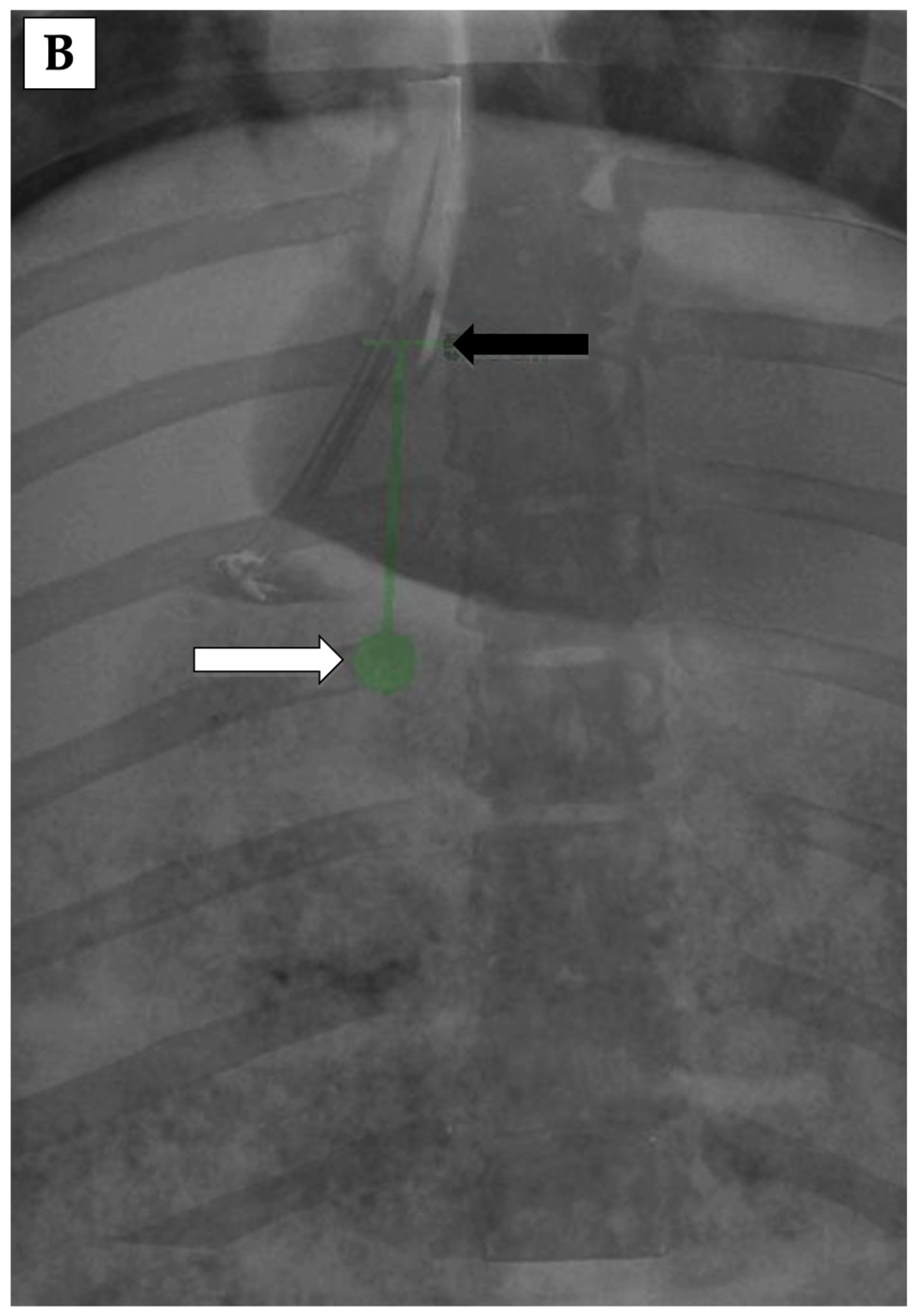 Applsci 12 05267 g001b