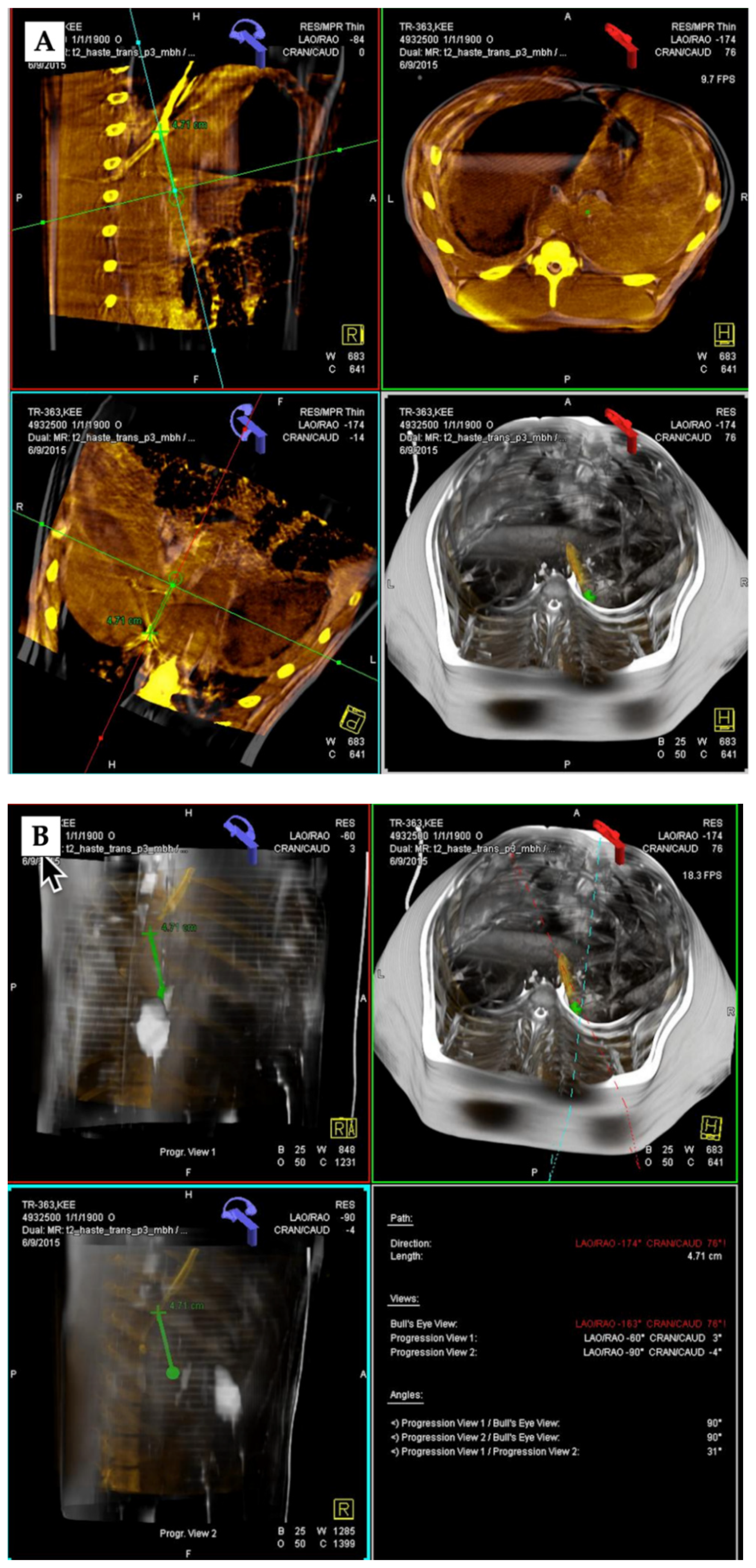 Applsci 12 05267 g002
