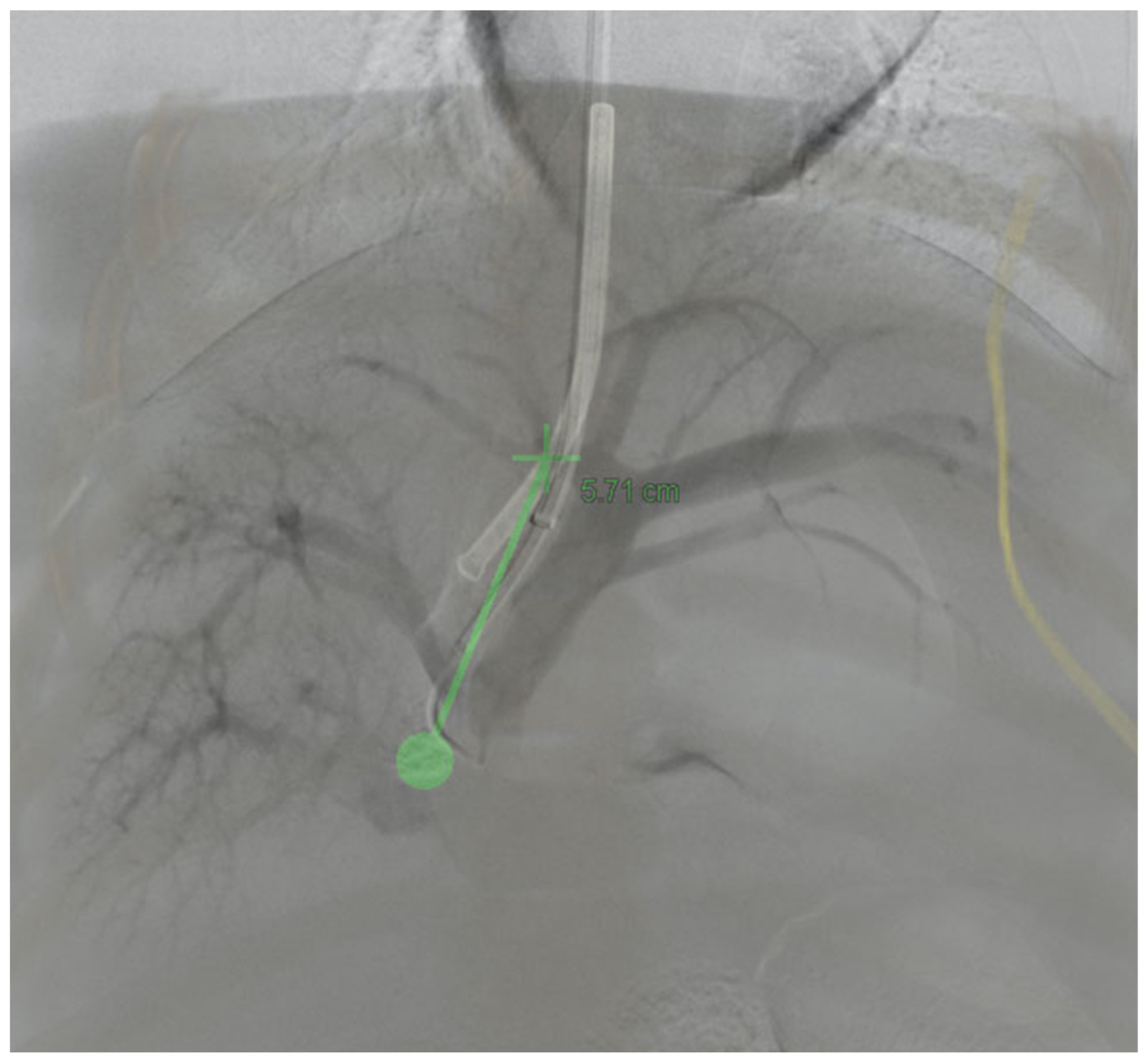 Applsci 12 05267 g004