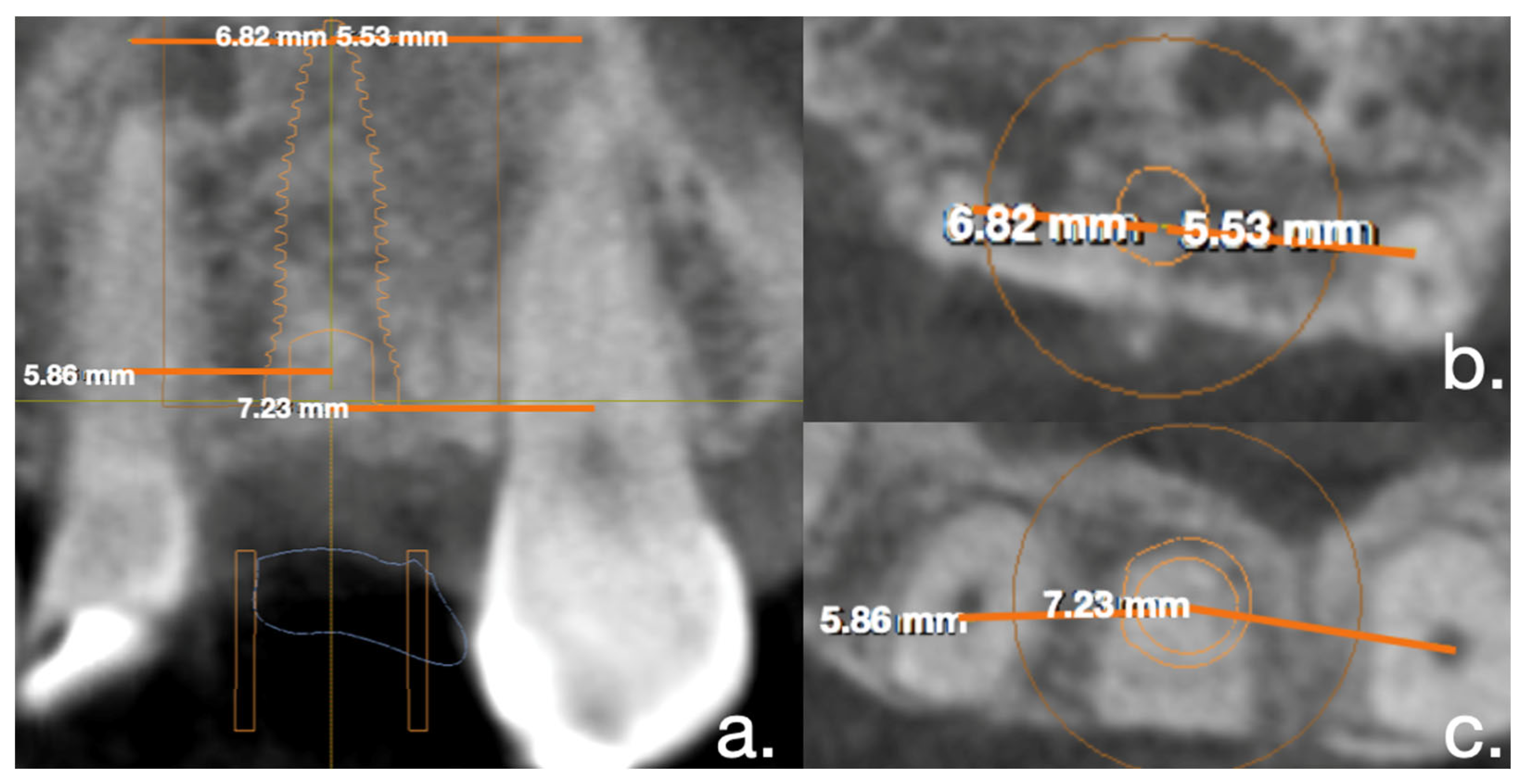 Applsci 12 05461 g002