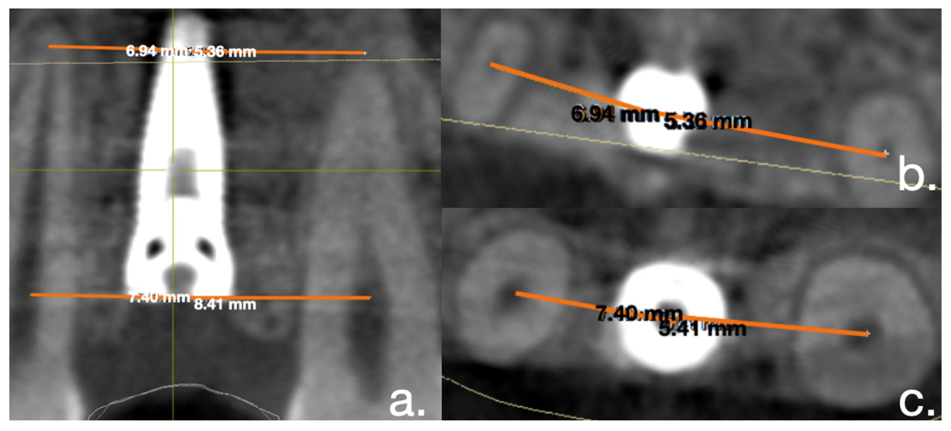 Applsci 12 05461 g003