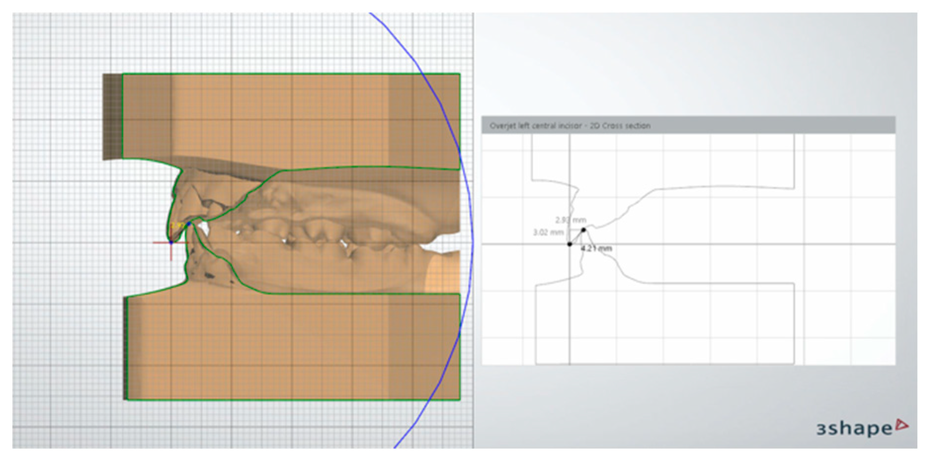 Applsci 12 05622 g005