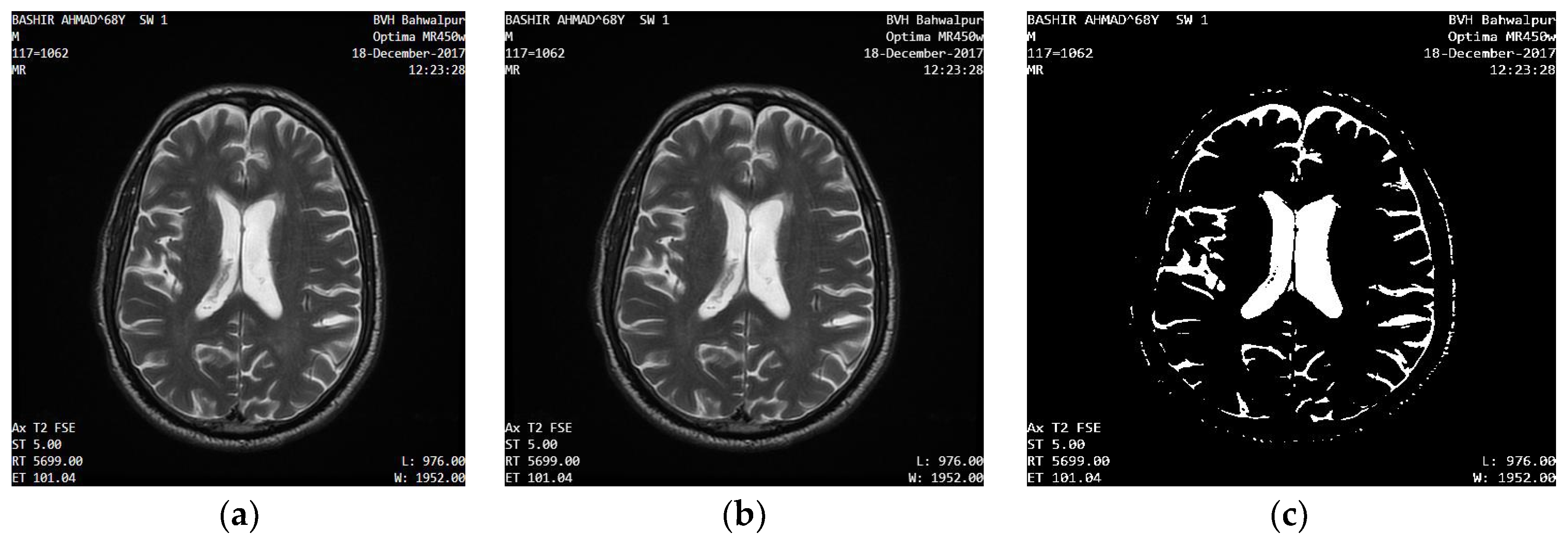 Applsci 12 05744 g001