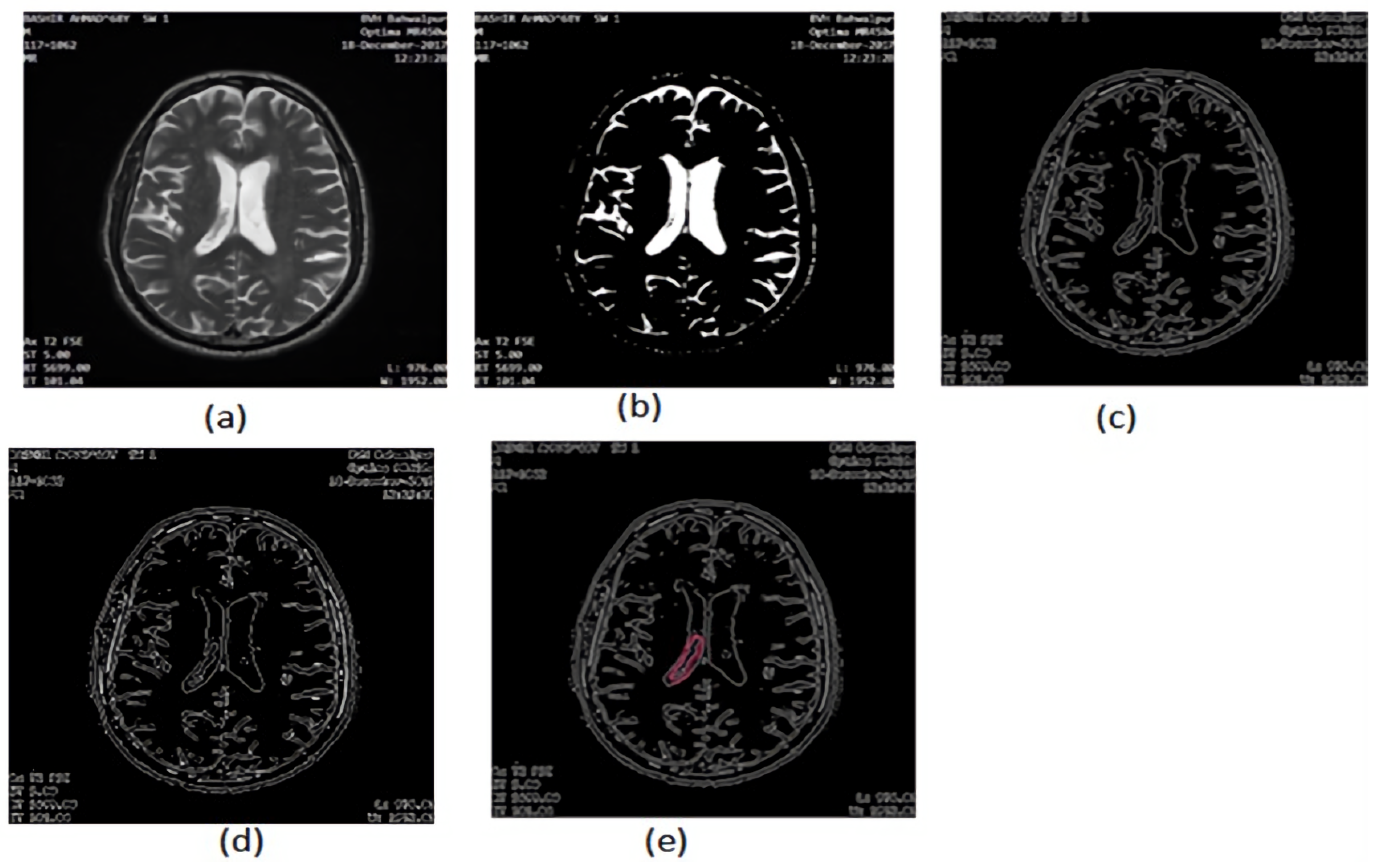 Applsci 12 05744 g006