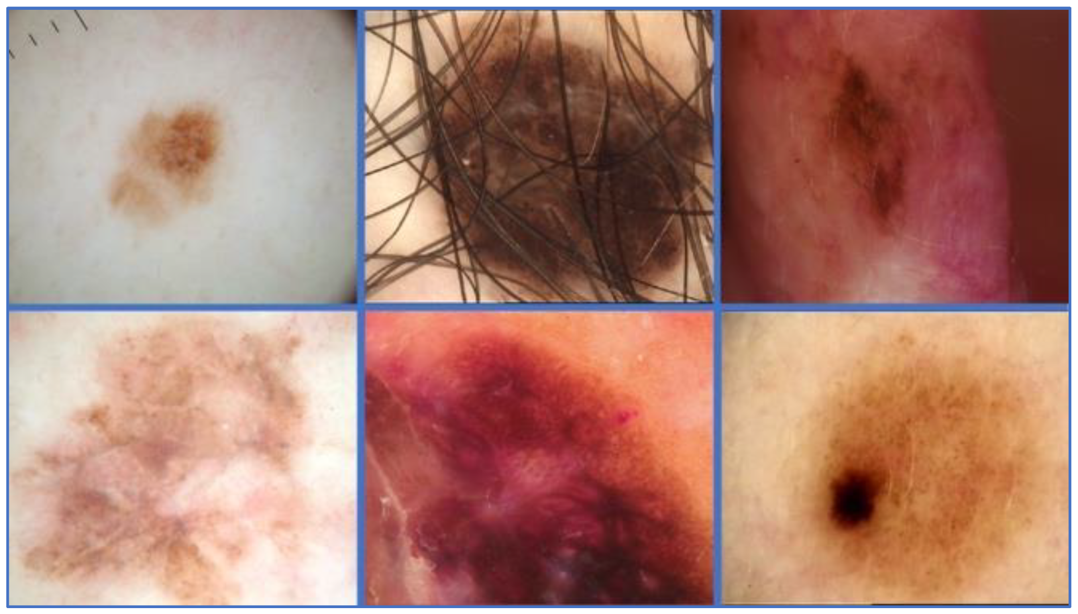 Applsci 12 05990 g001