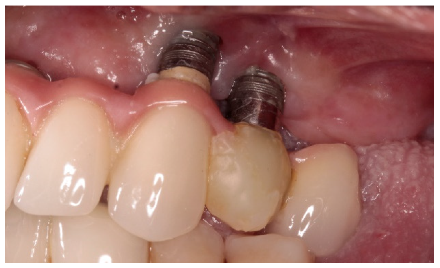 Applsci 12 06980 g001