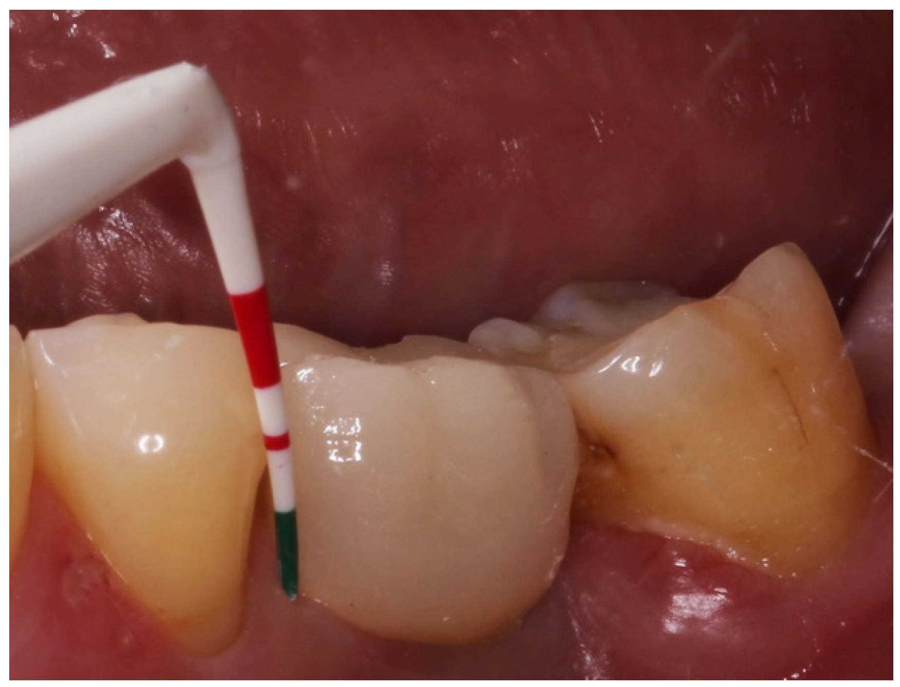 Applsci 12 06980 g003