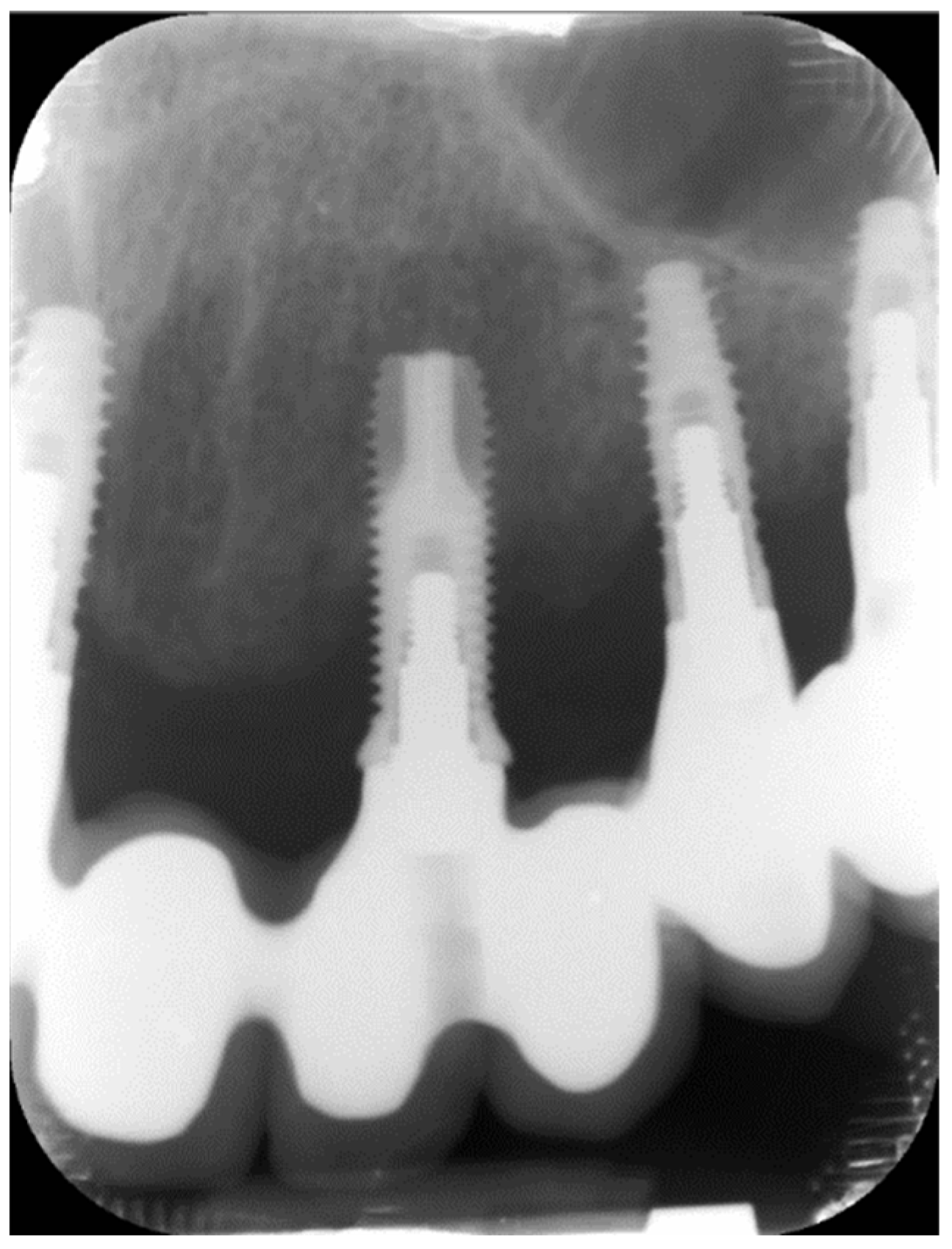 Applsci 12 06980 g004