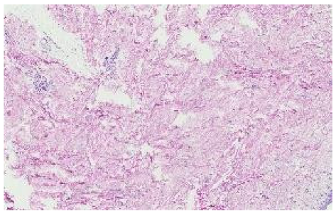 Applsci 12 07511 i007