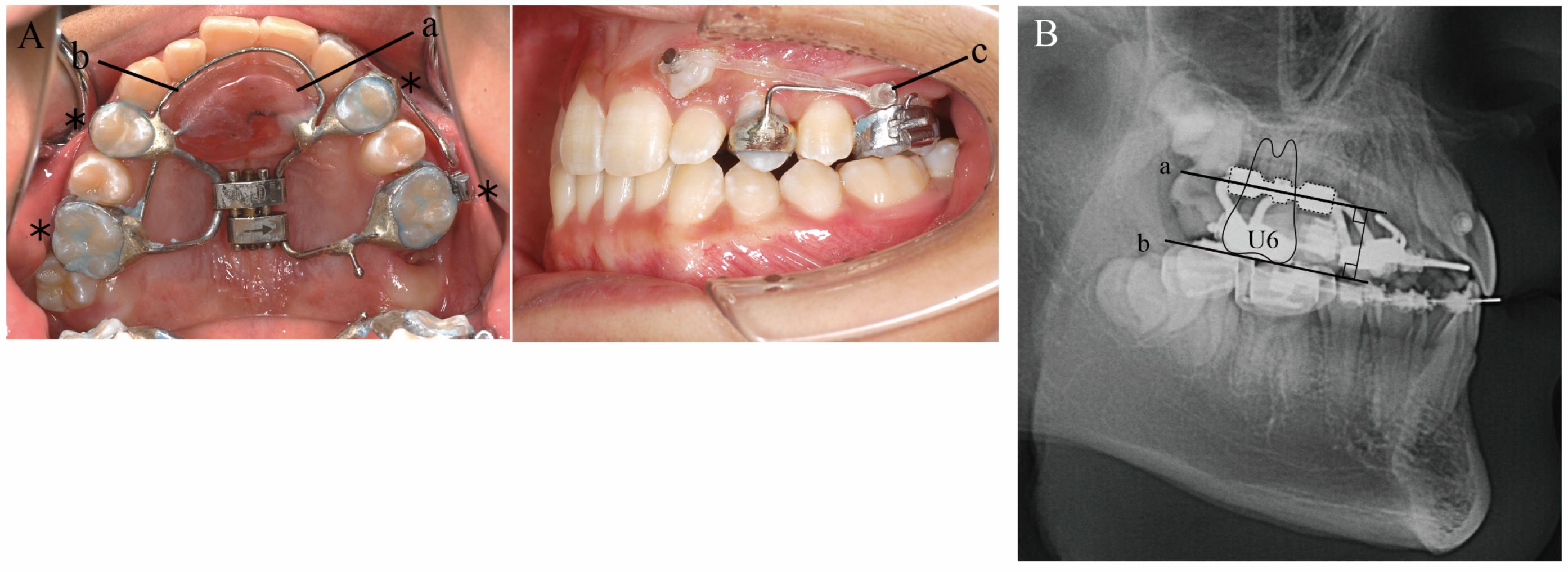 Applsci 12 07620 g005