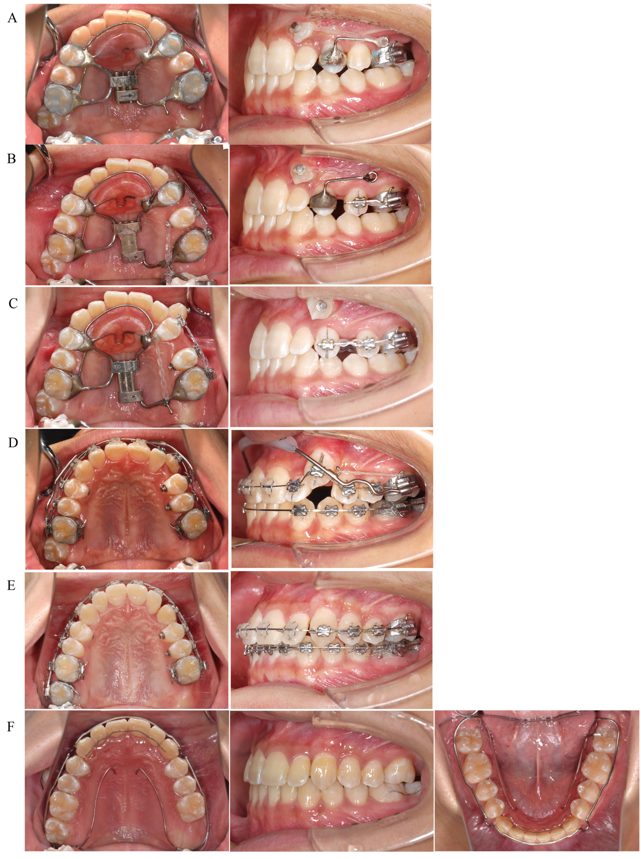 Applsci 12 07620 g006