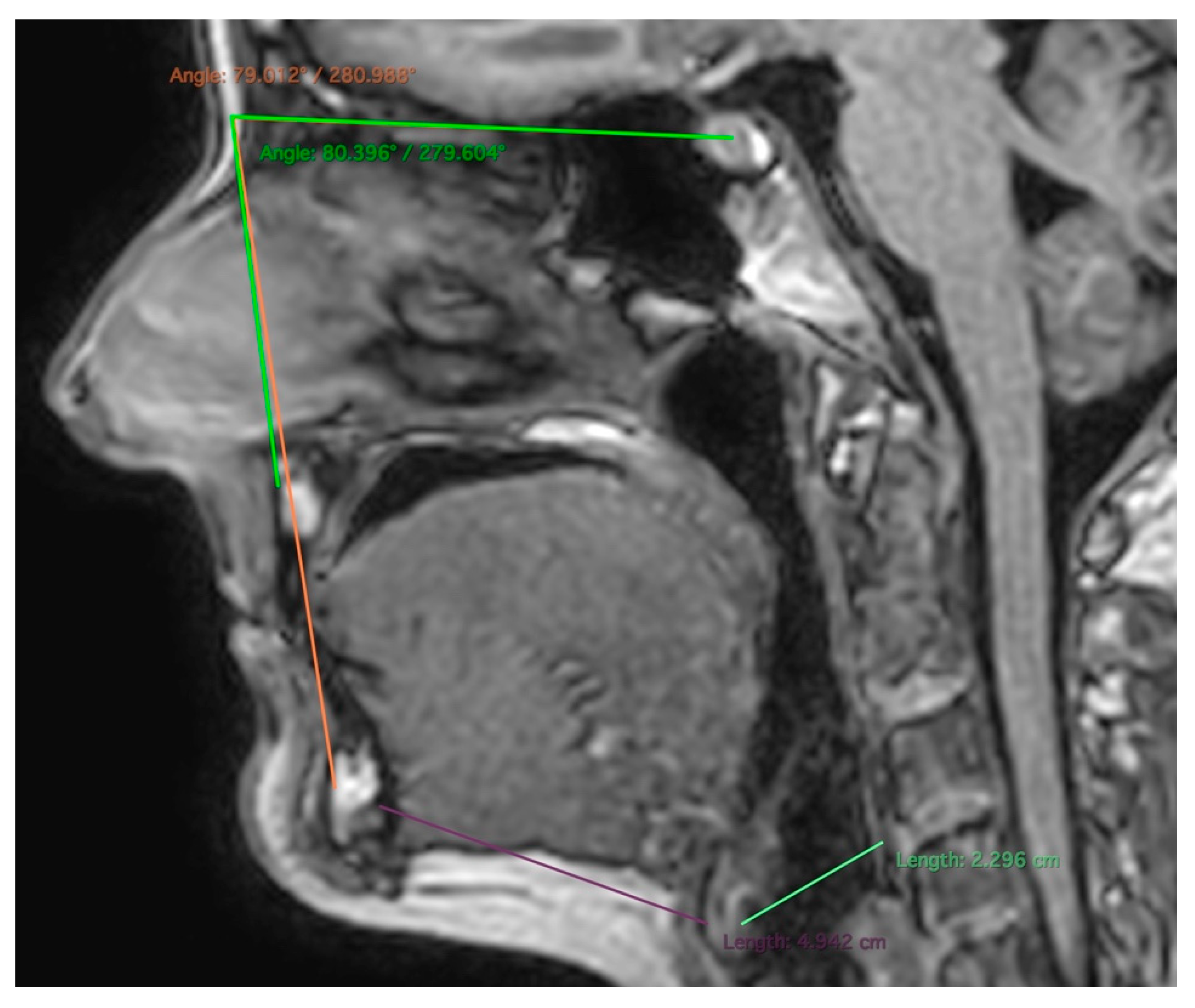 Applsci 12 07646 g001