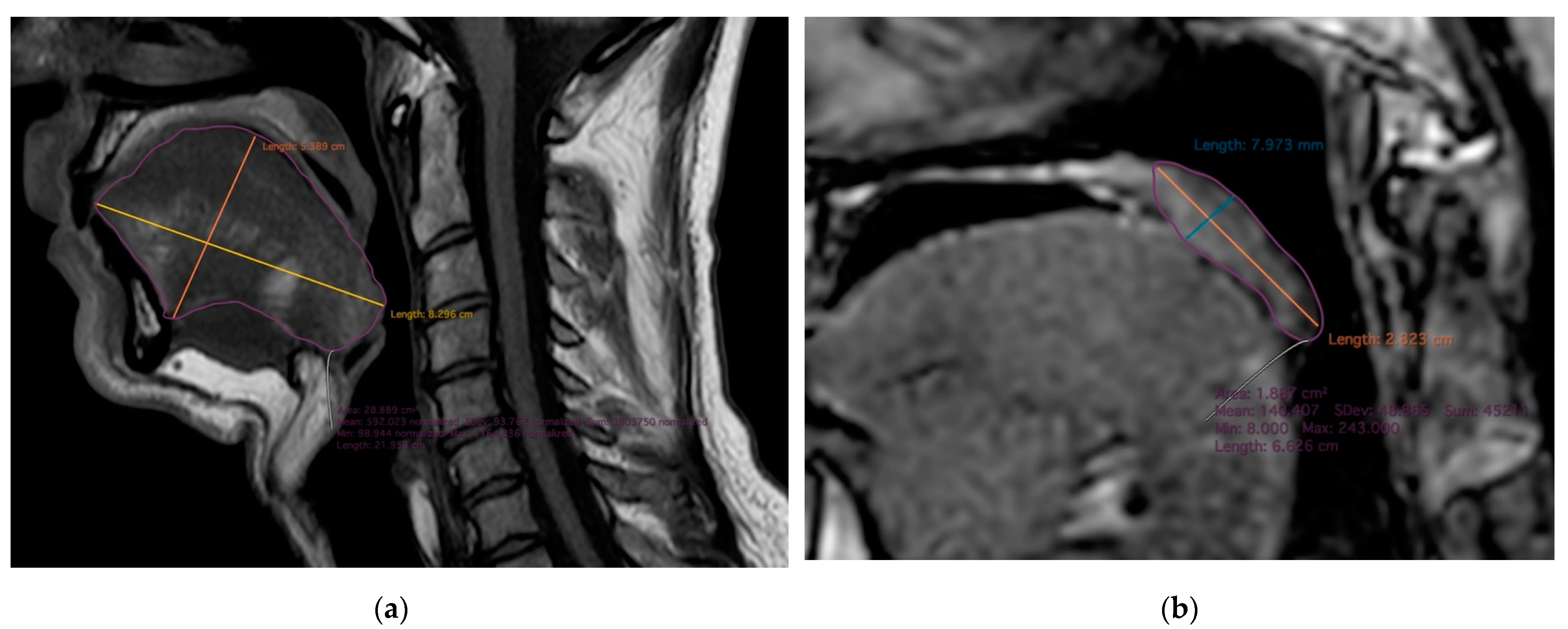 Applsci 12 07646 g003