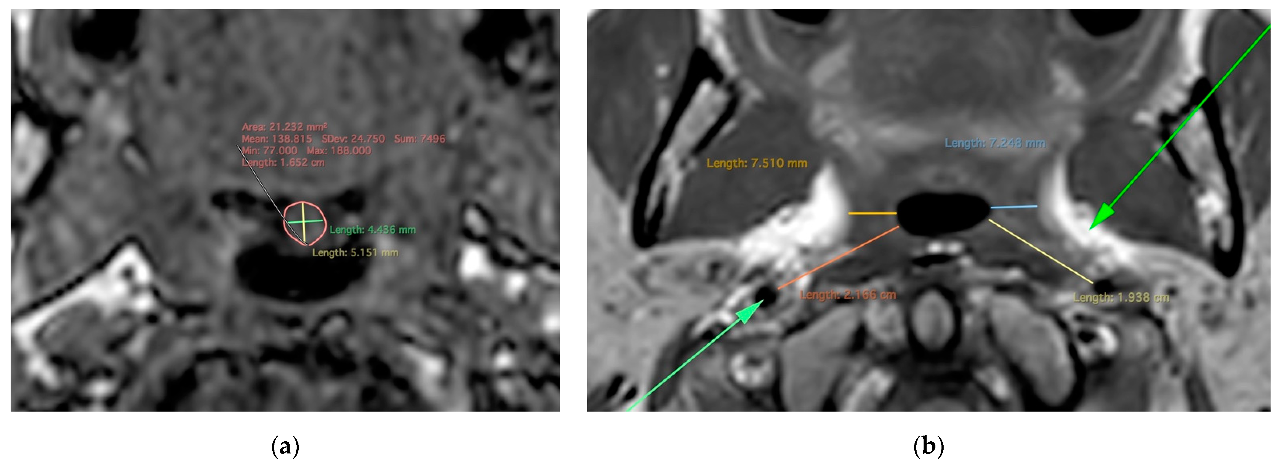 Applsci 12 07646 g004