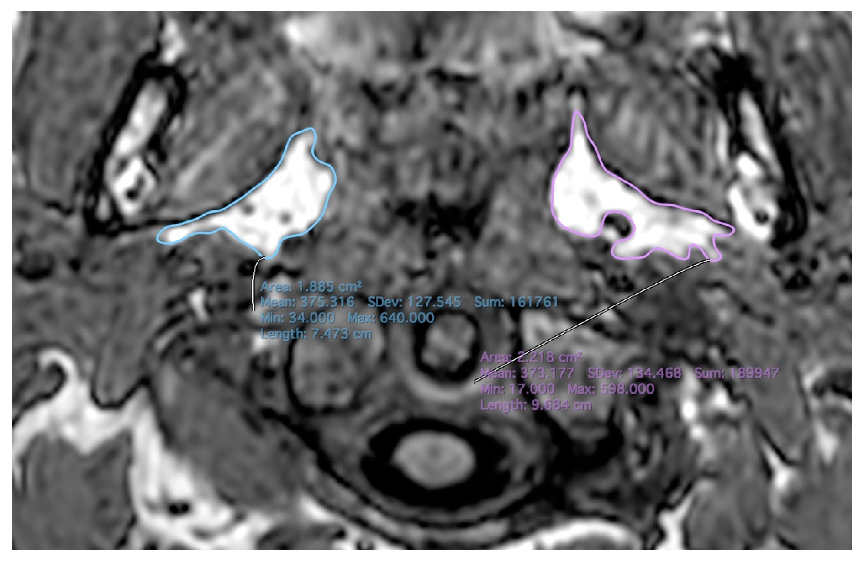 Applsci 12 07646 g005