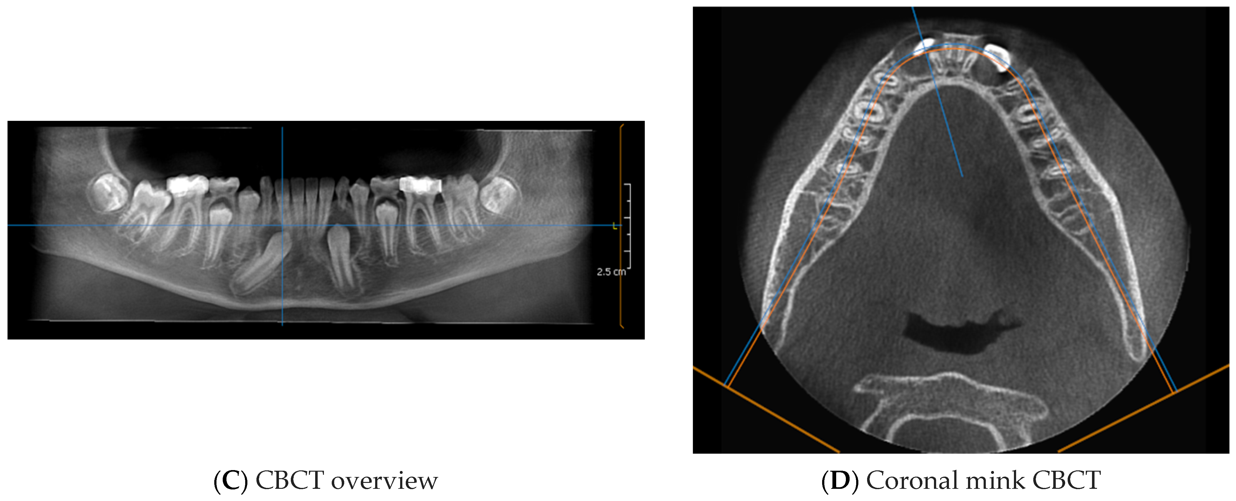 Applsci 12 08008 g009b