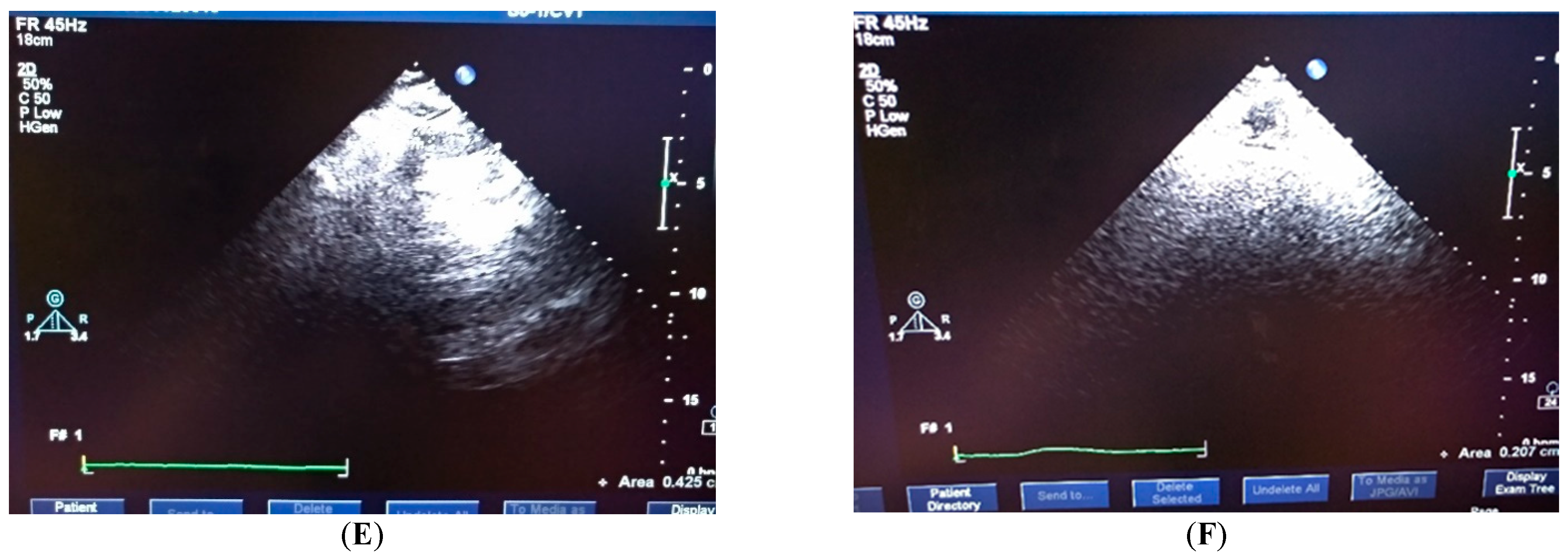 Applsci 12 08197 g005b