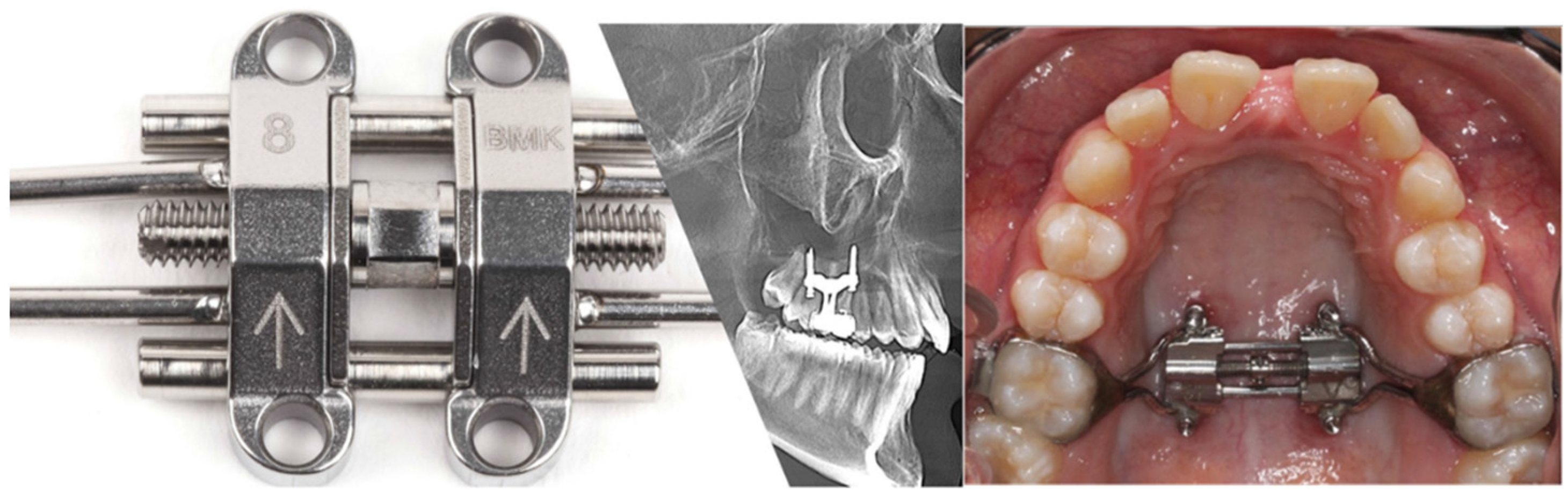 Applsci 12 08742 g001