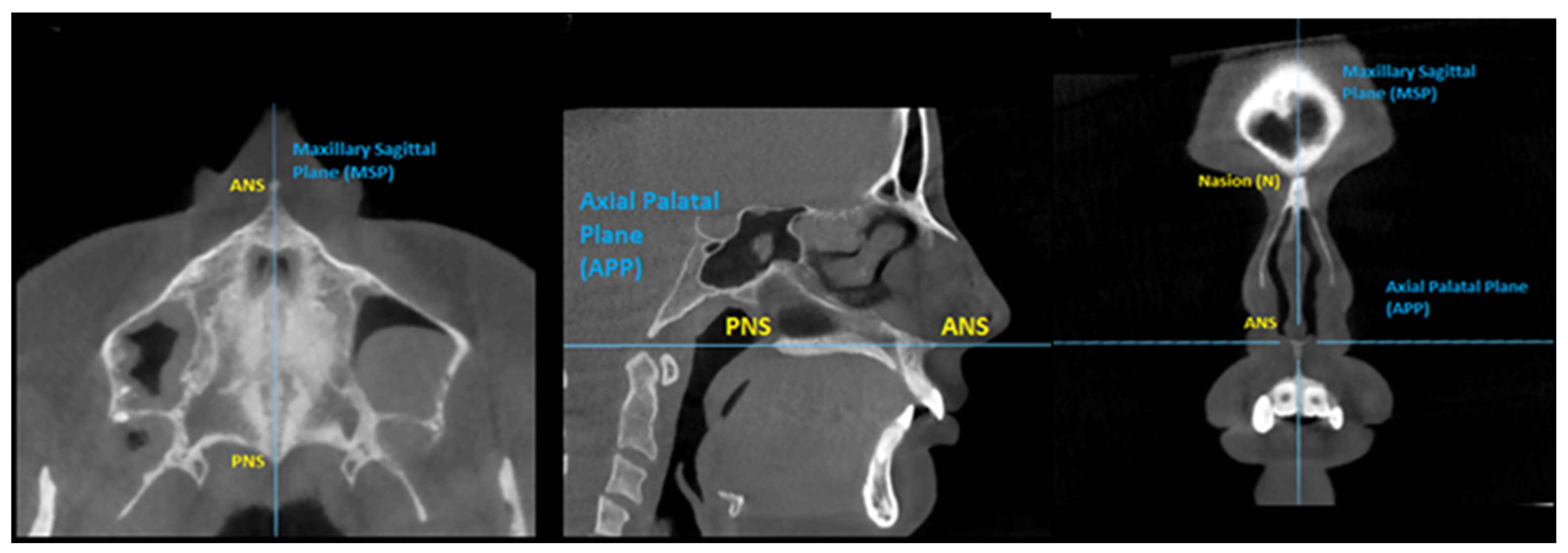 Applsci 12 08742 g003