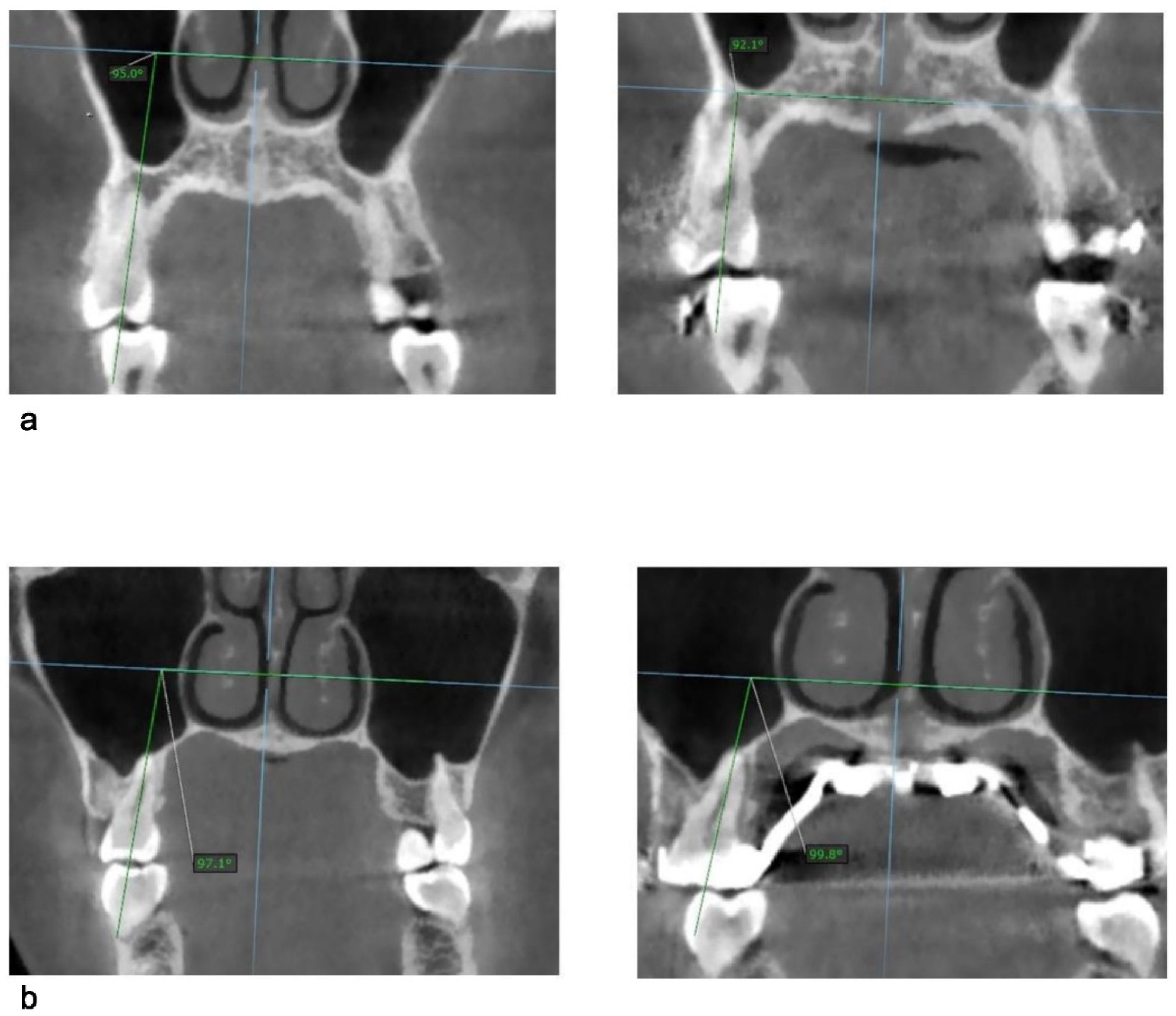 Applsci 12 08742 g004