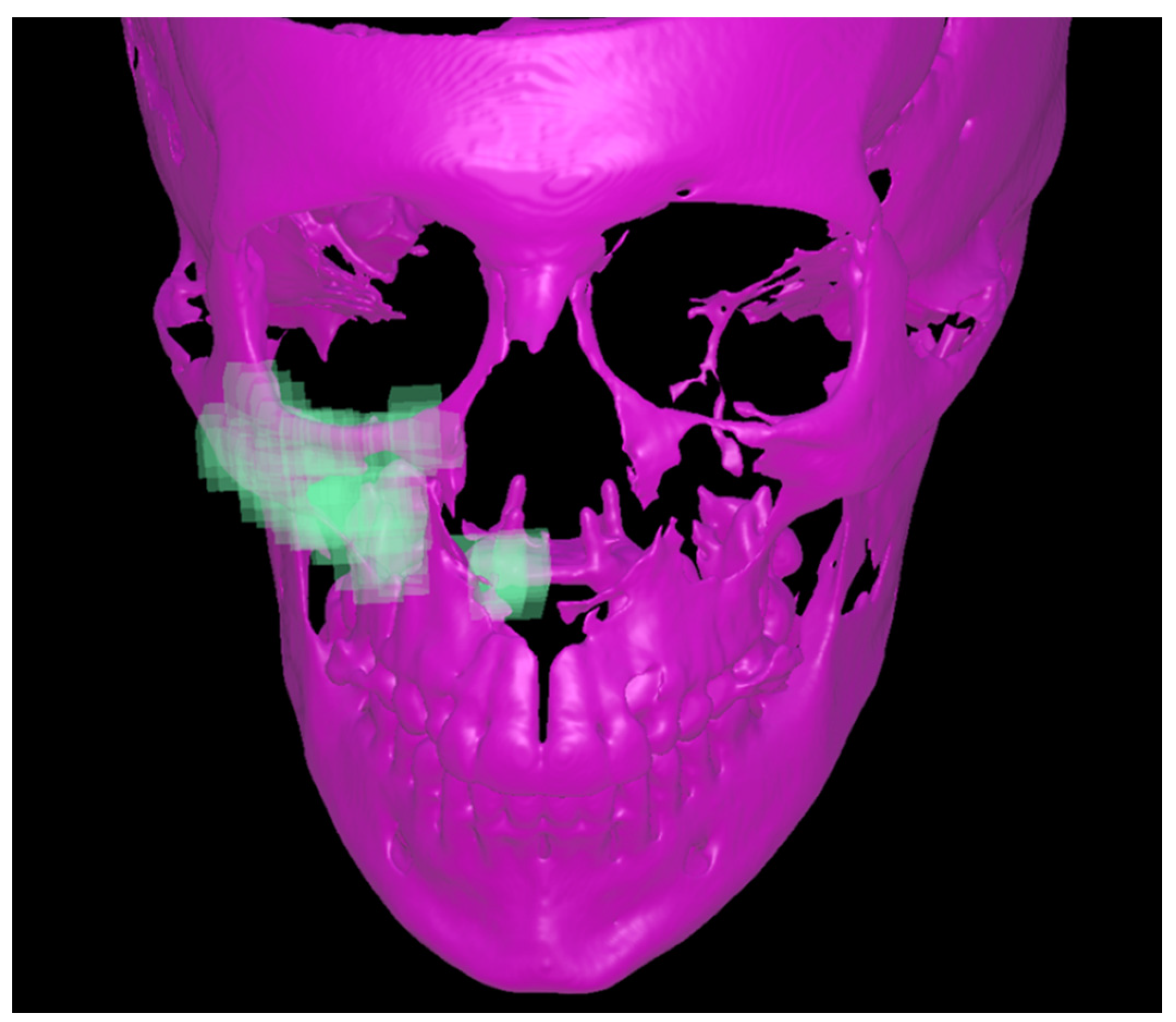 Applsci 12 08742 g005