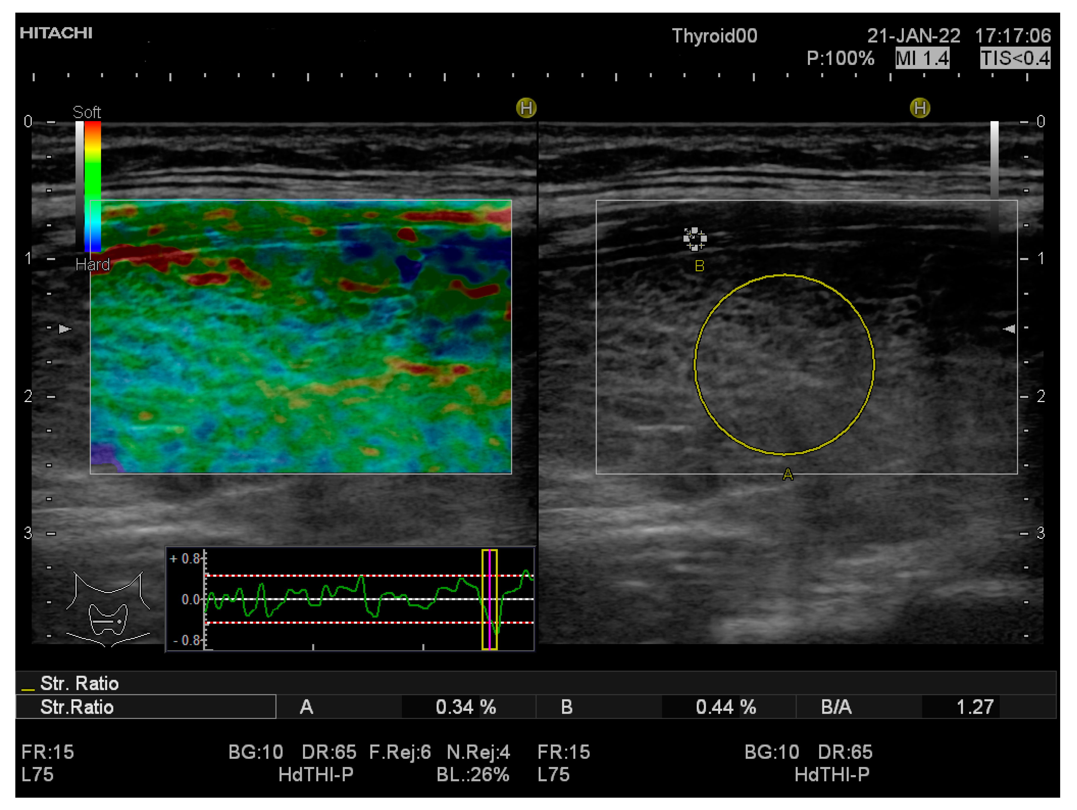 Applsci 12 08881 g001
