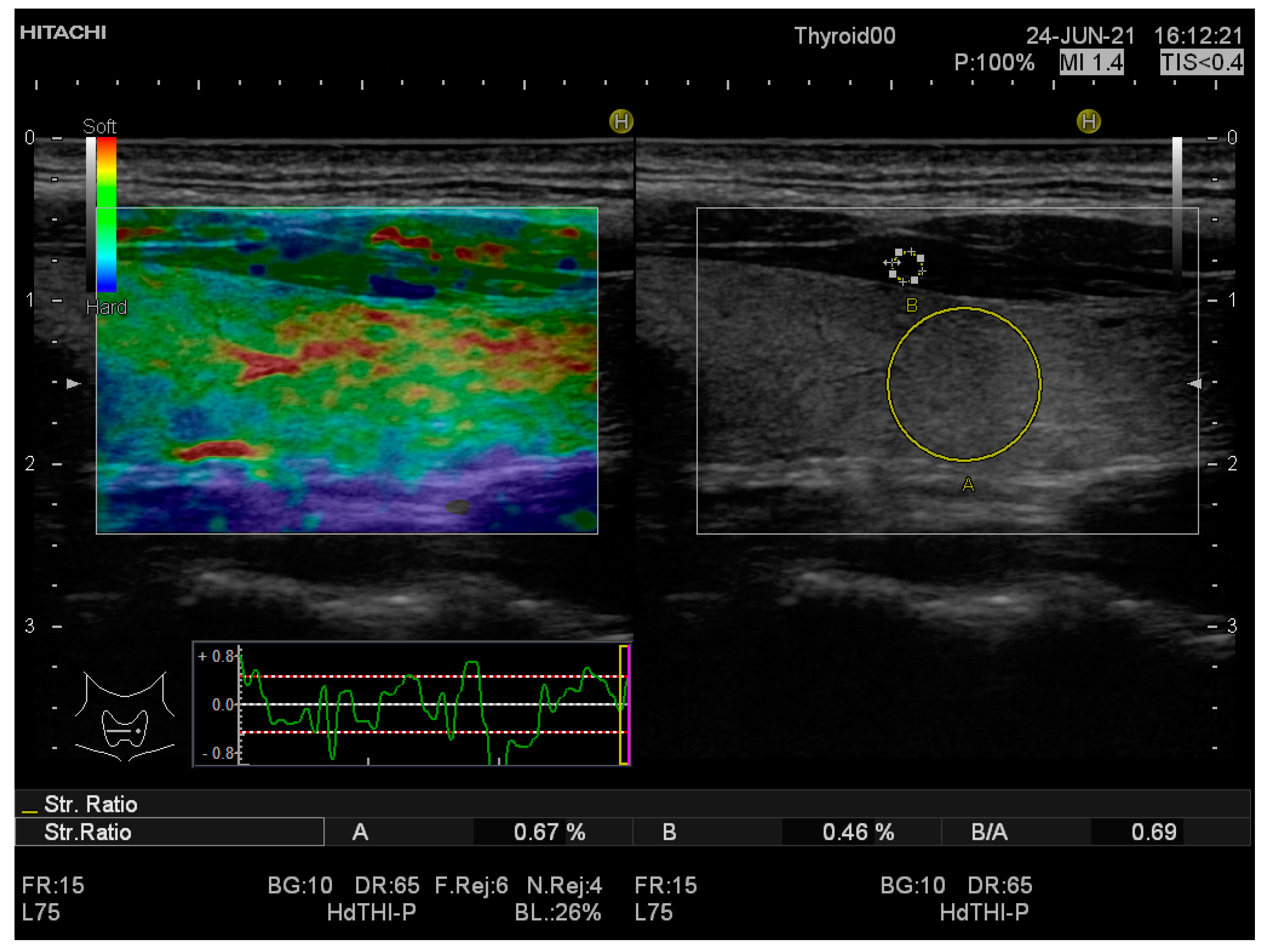 Applsci 12 08881 g002