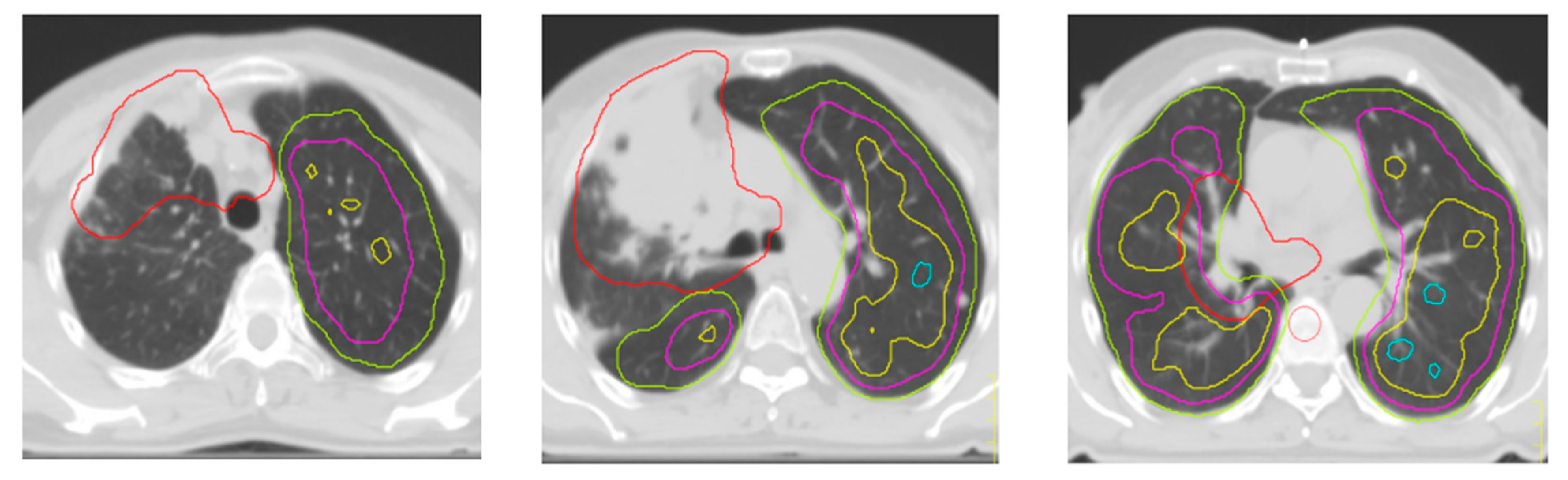 Applsci 12 09351 g002