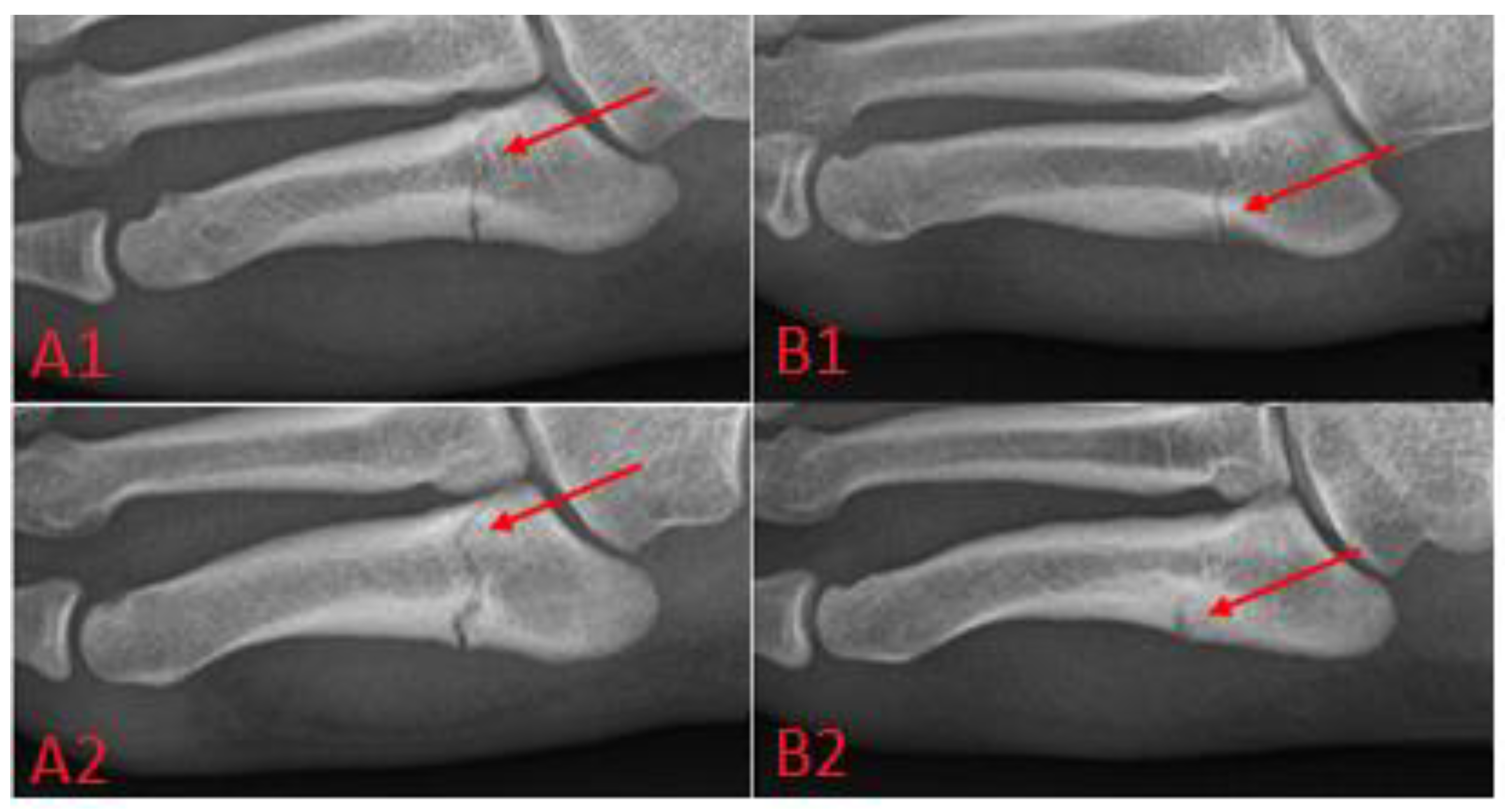 Applsci 12 09615 g003 Applsci 12 09615 g003