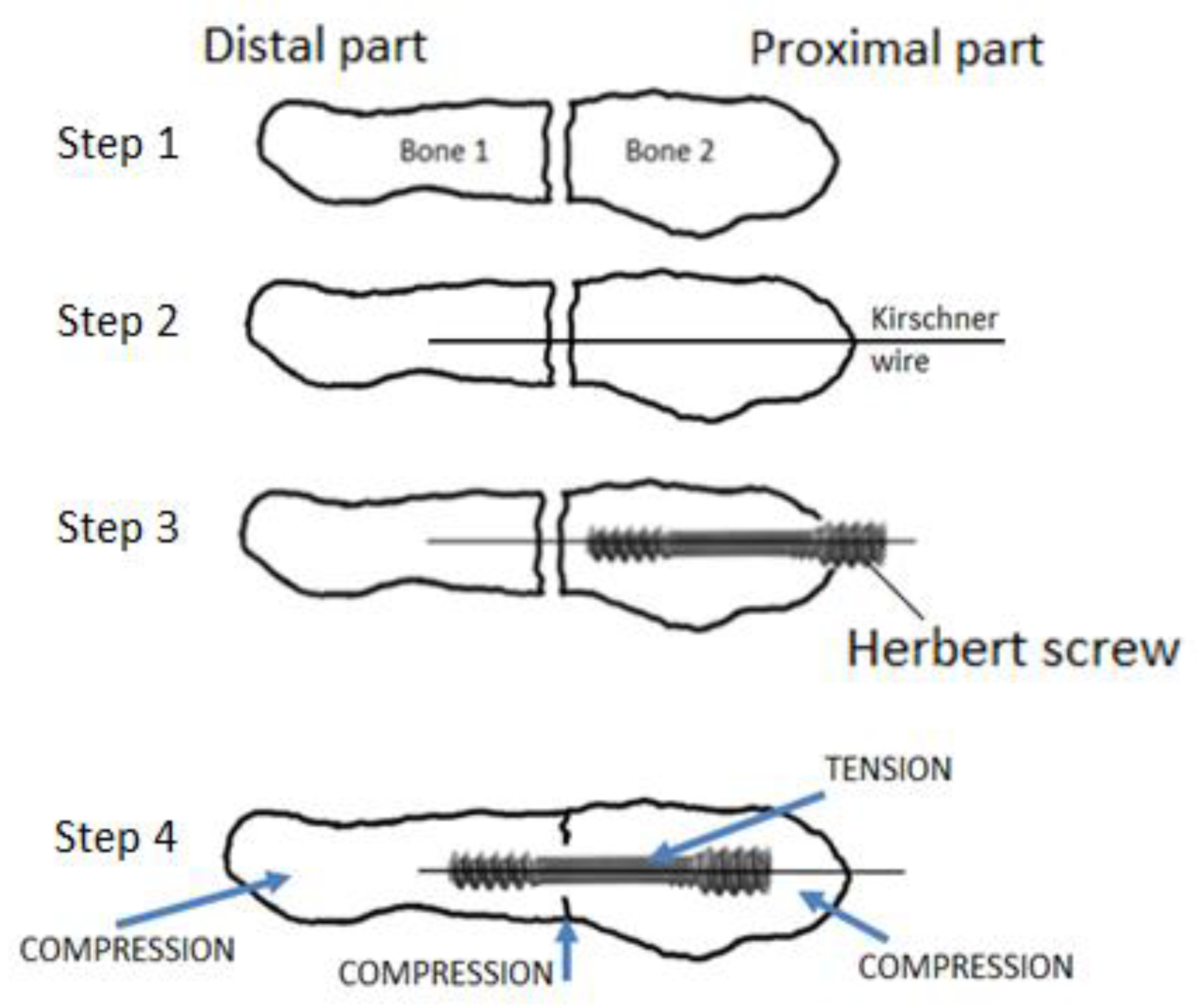 Applsci 12 09615 g004 Applsci 12 09615 g004