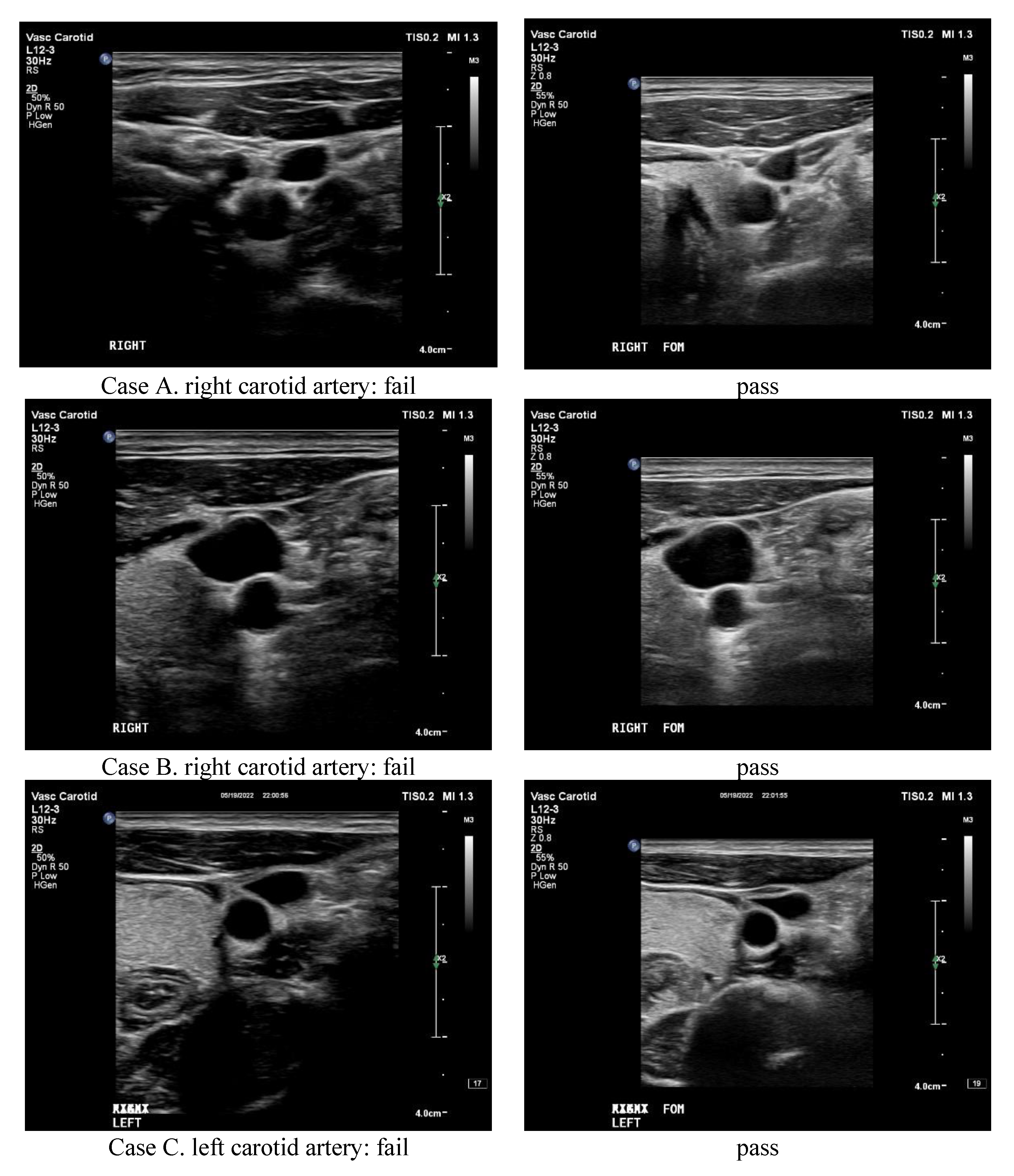 Applsci 12 09751 g005a