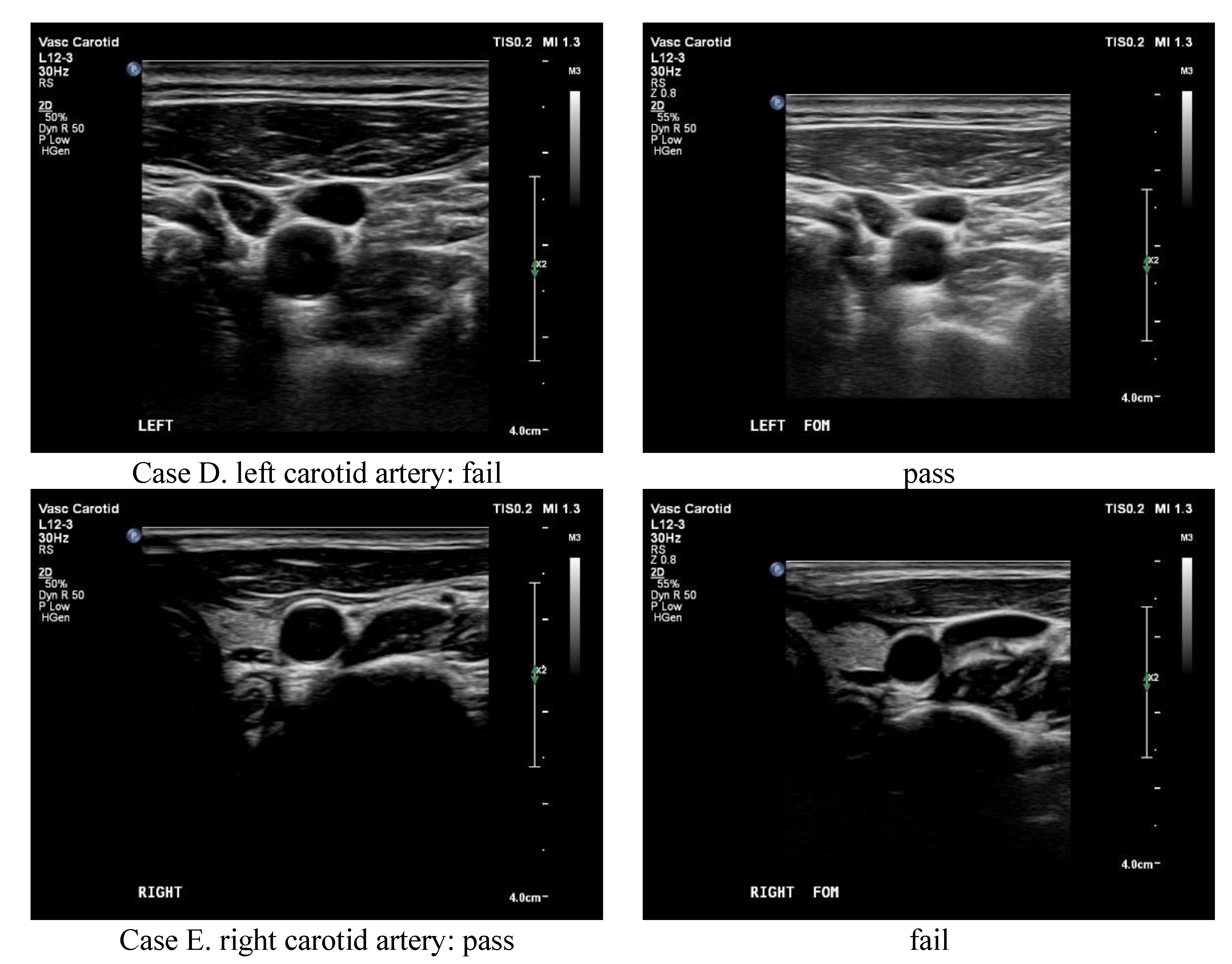 Applsci 12 09751 g005b
