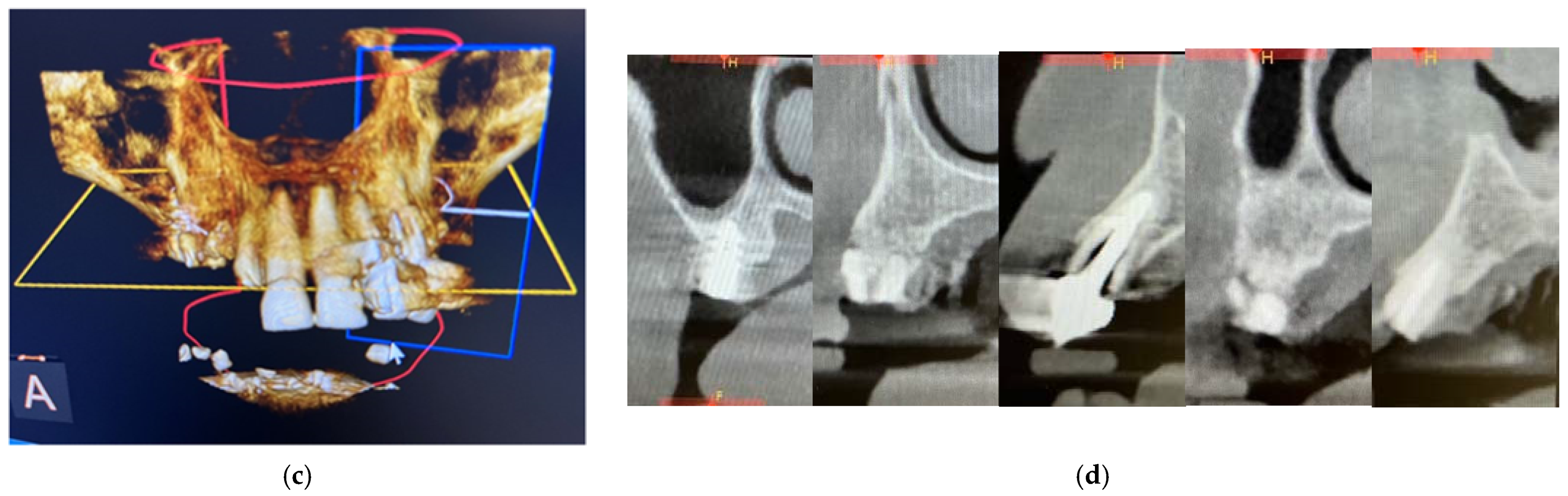 Applsci 12 09995 g004b