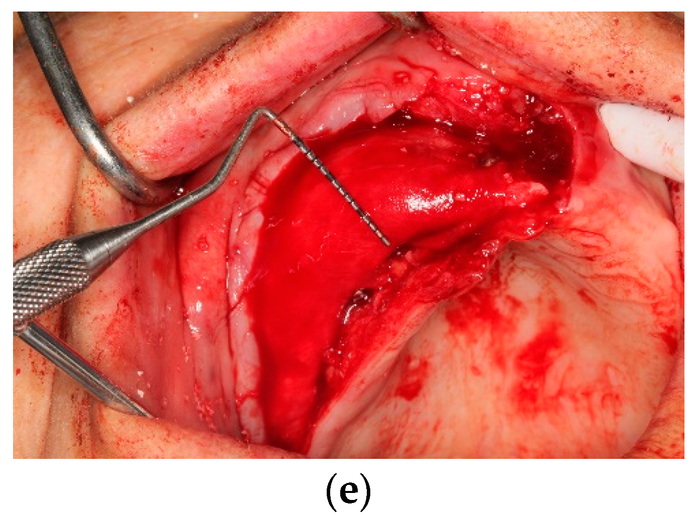 Applsci 12 10518 g002b