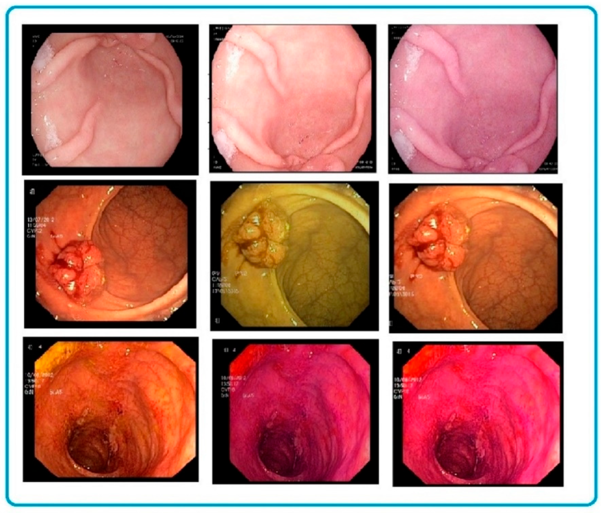 Applsci 12 10856 g005 Applsci 12 10856 g005