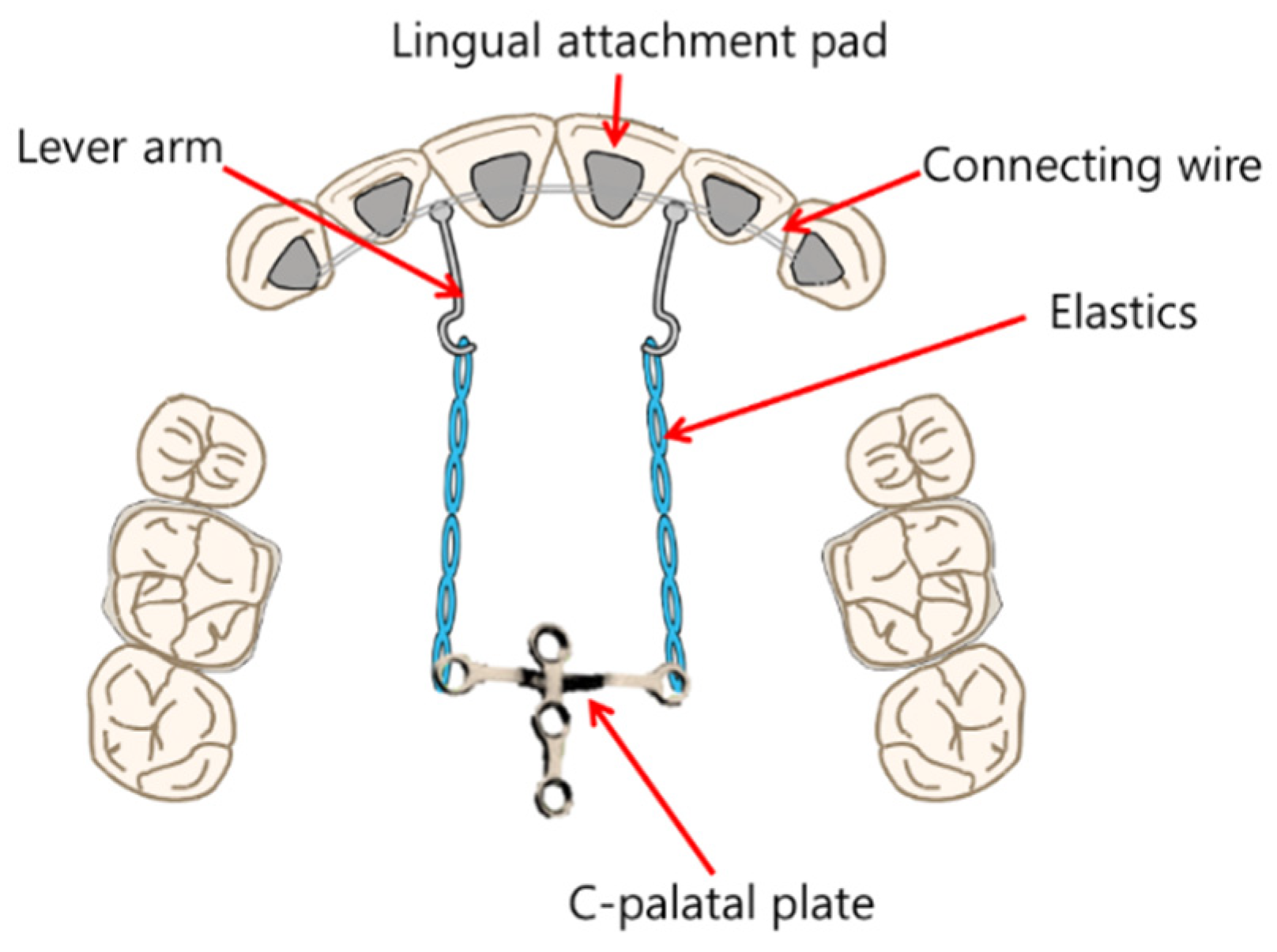 Applsci 12 11075 g001 Applsci 12 11075 g001