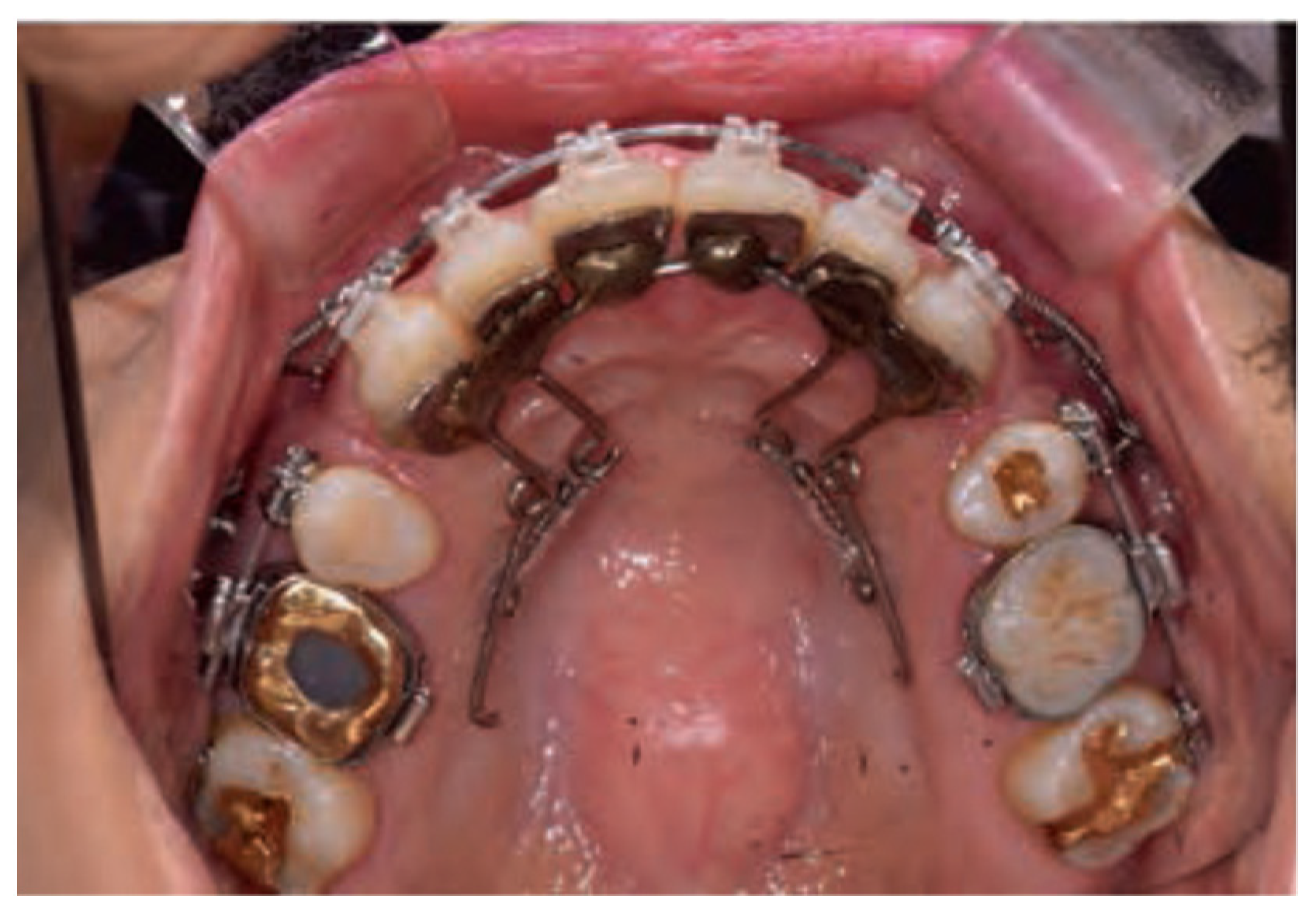 Applsci 12 11075 g003 Applsci 12 11075 g003