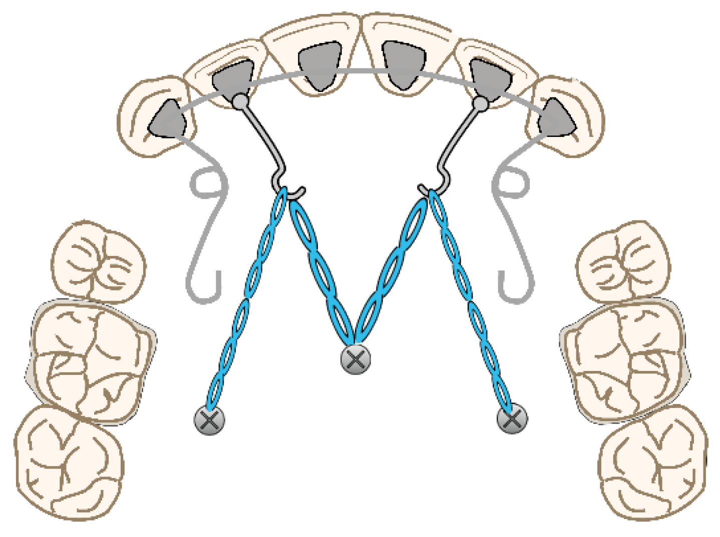 Applsci 12 11075 g005 Applsci 12 11075 g005