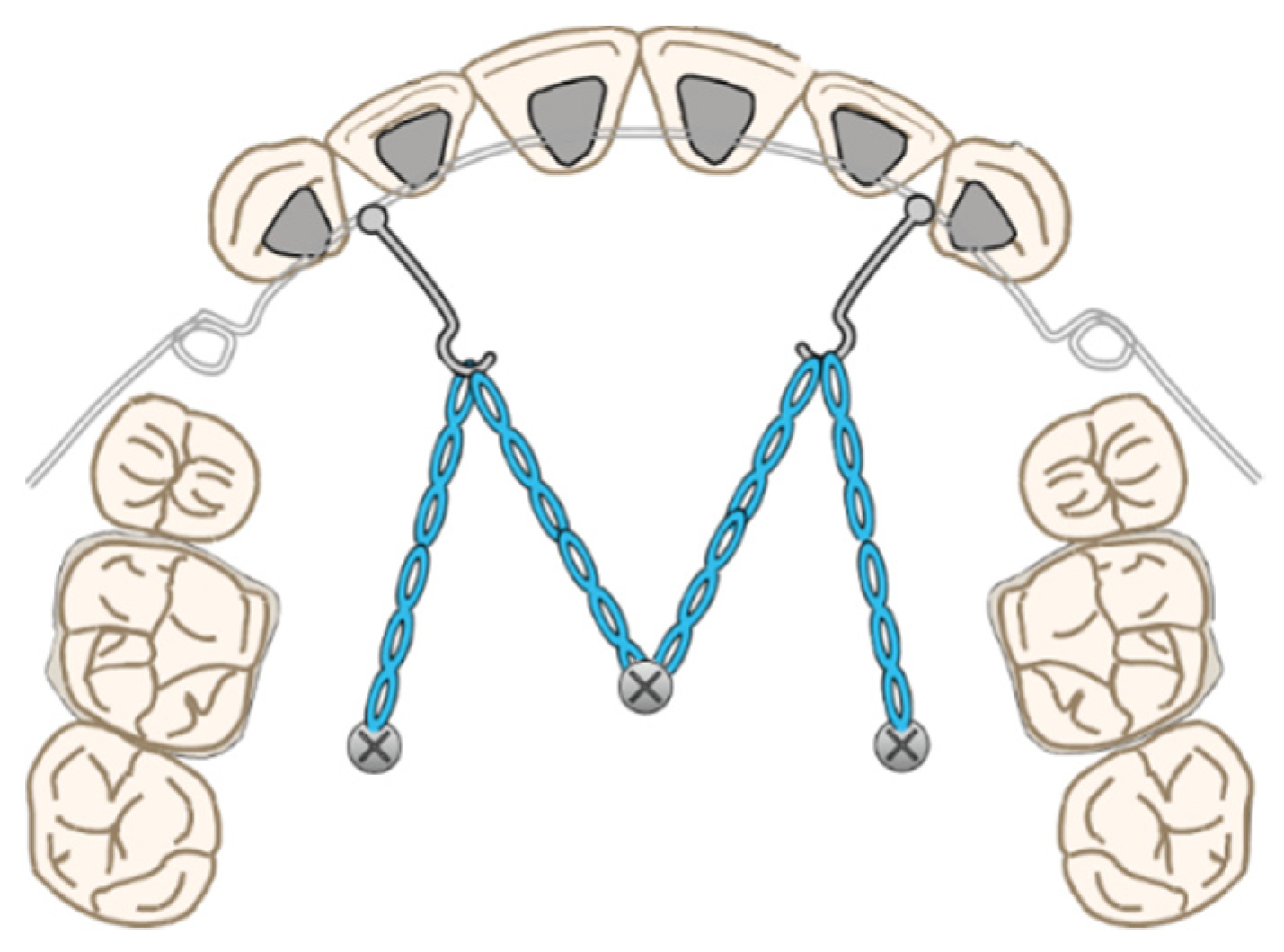 Applsci 12 11075 g006 Applsci 12 11075 g006