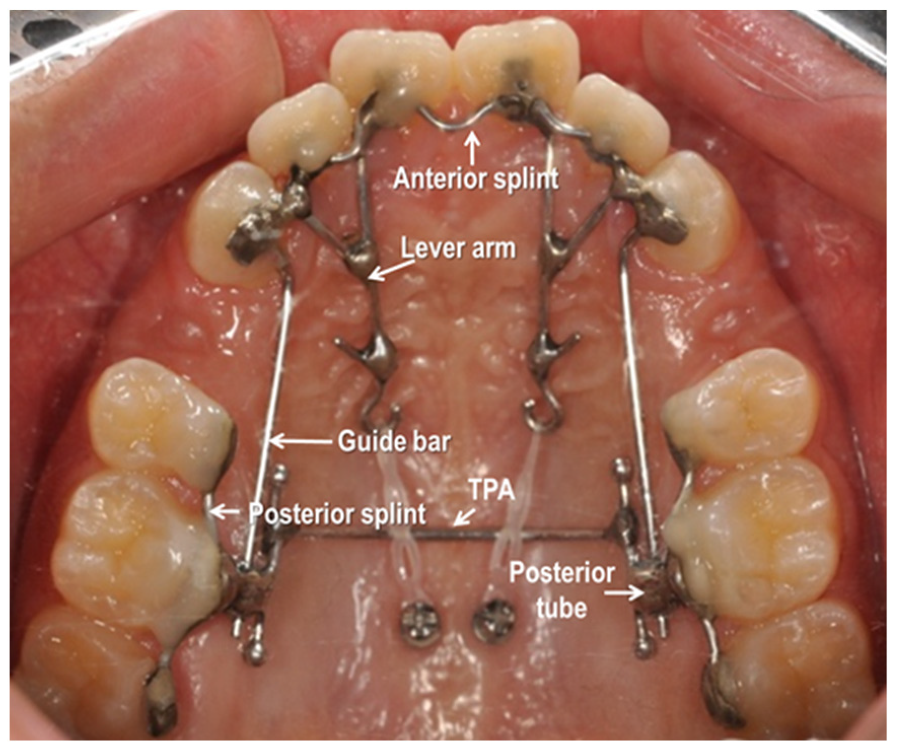 Applsci 12 11075 g007 Applsci 12 11075 g007