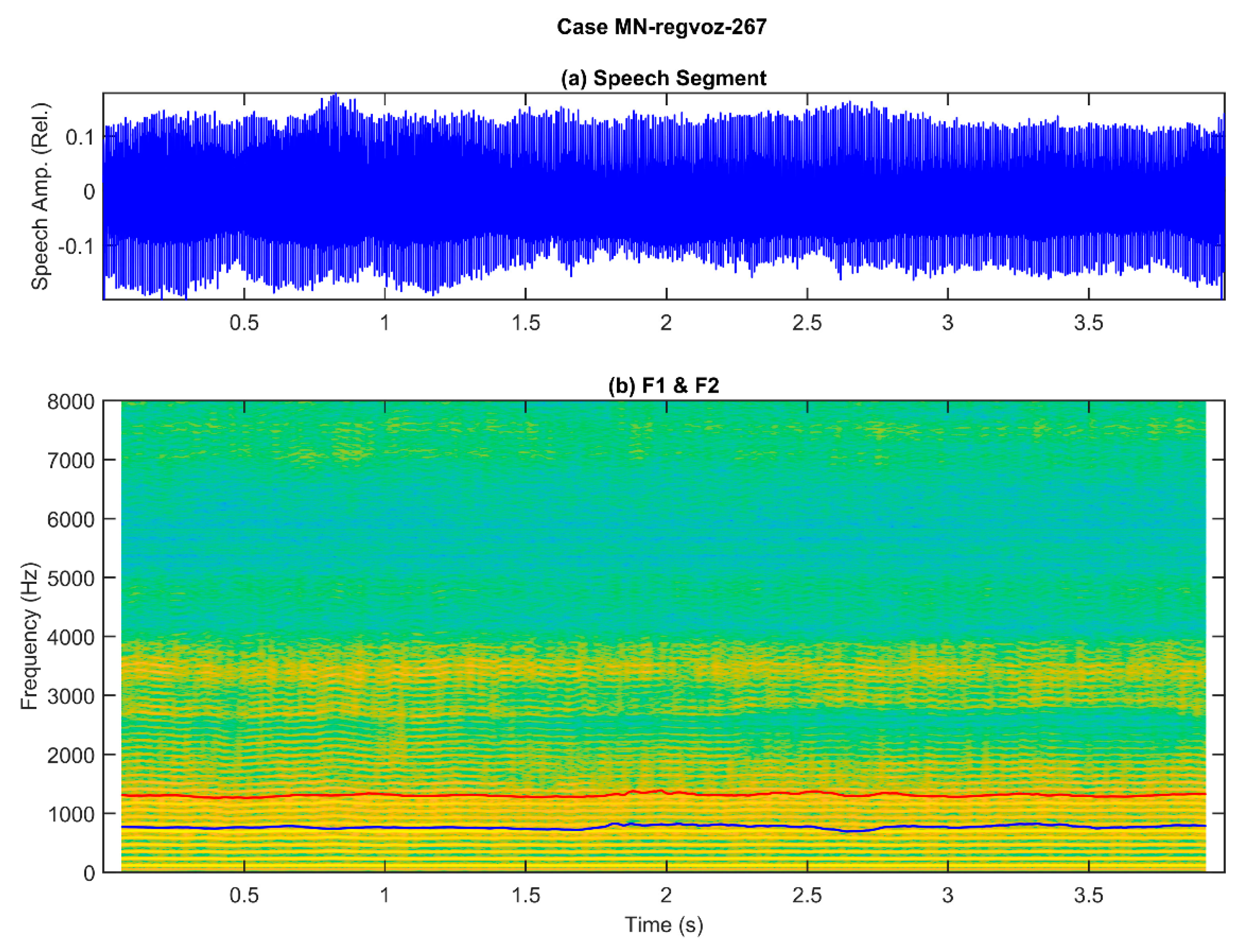 Applsci 12 11095 g001