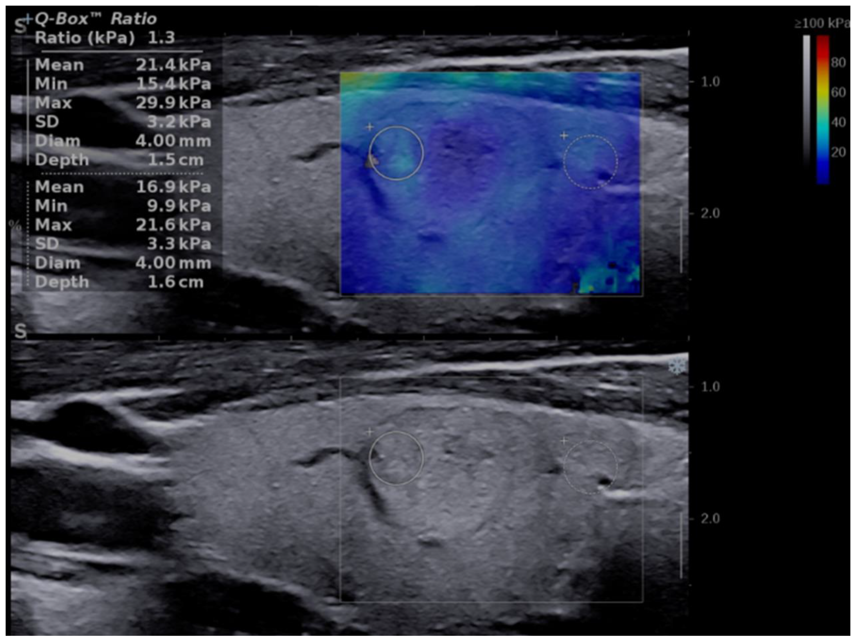 Applsci 12 11147 g001