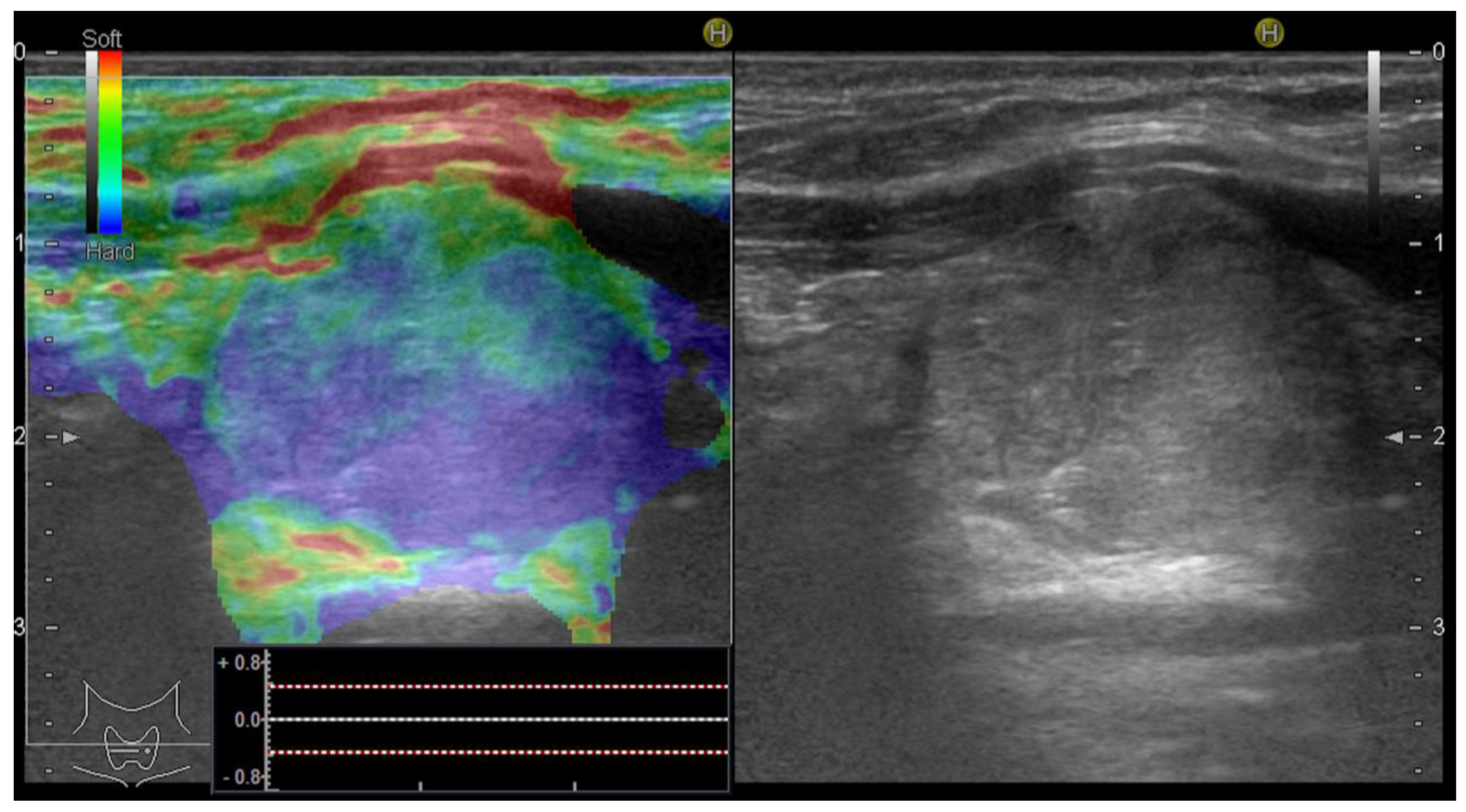 Applsci 12 11147 g006