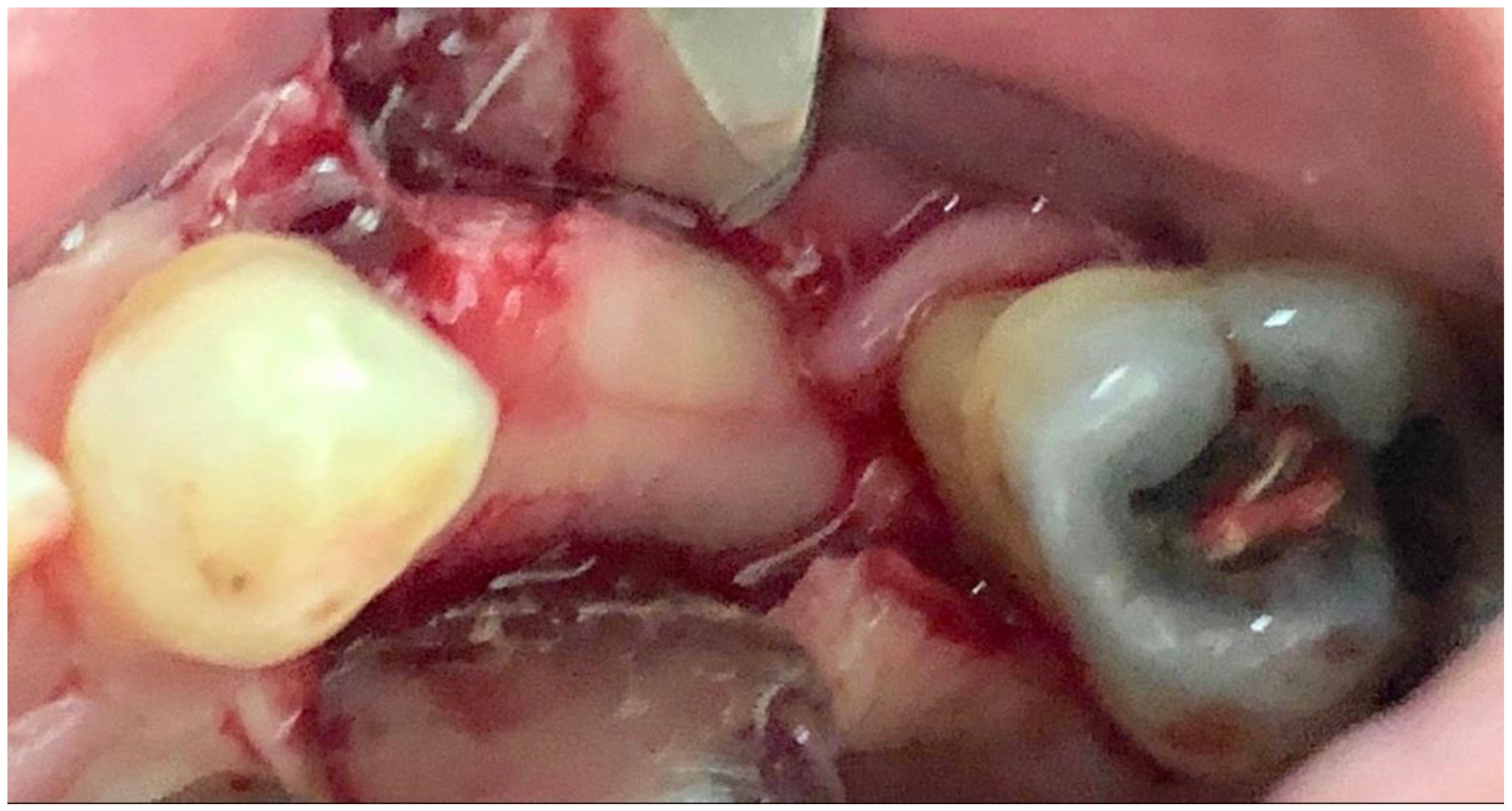 Applsci 12 11247 g003