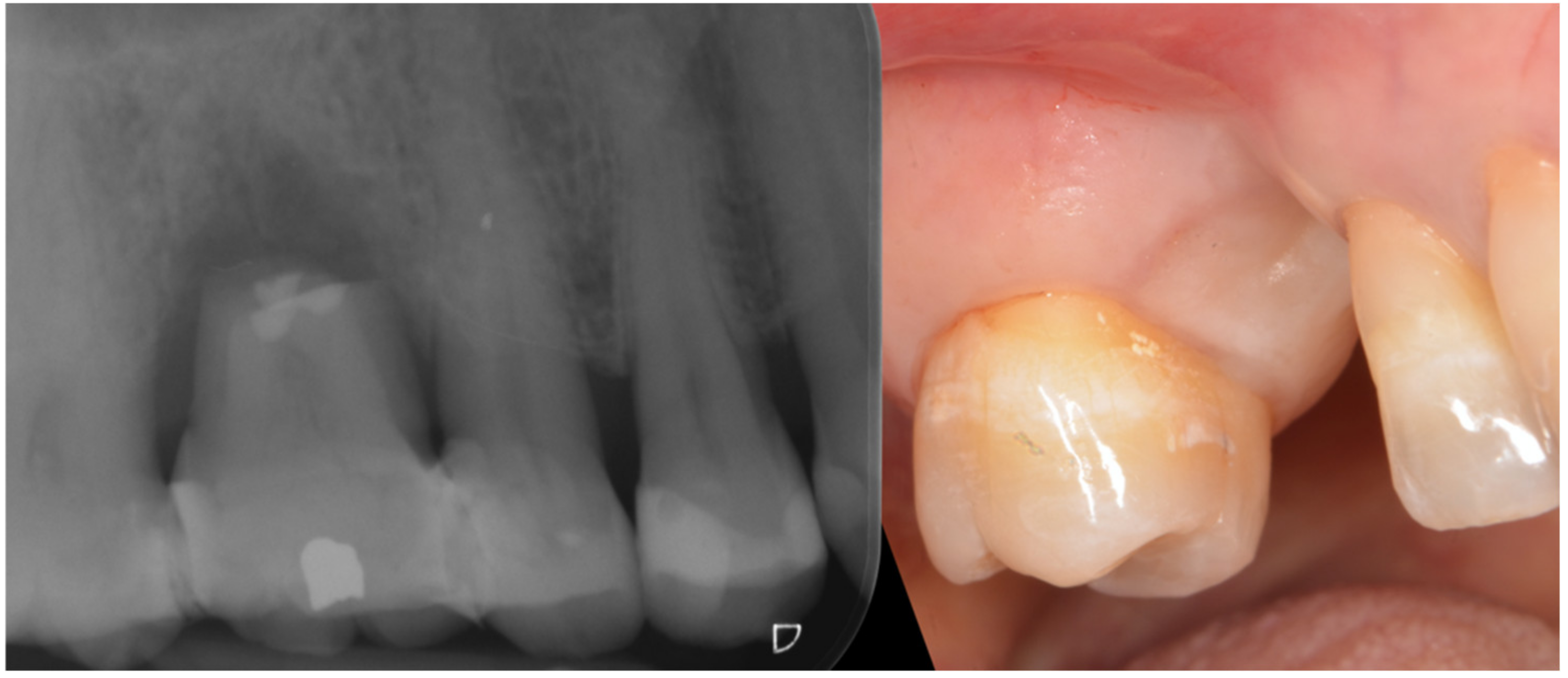 Applsci 12 11247 g005