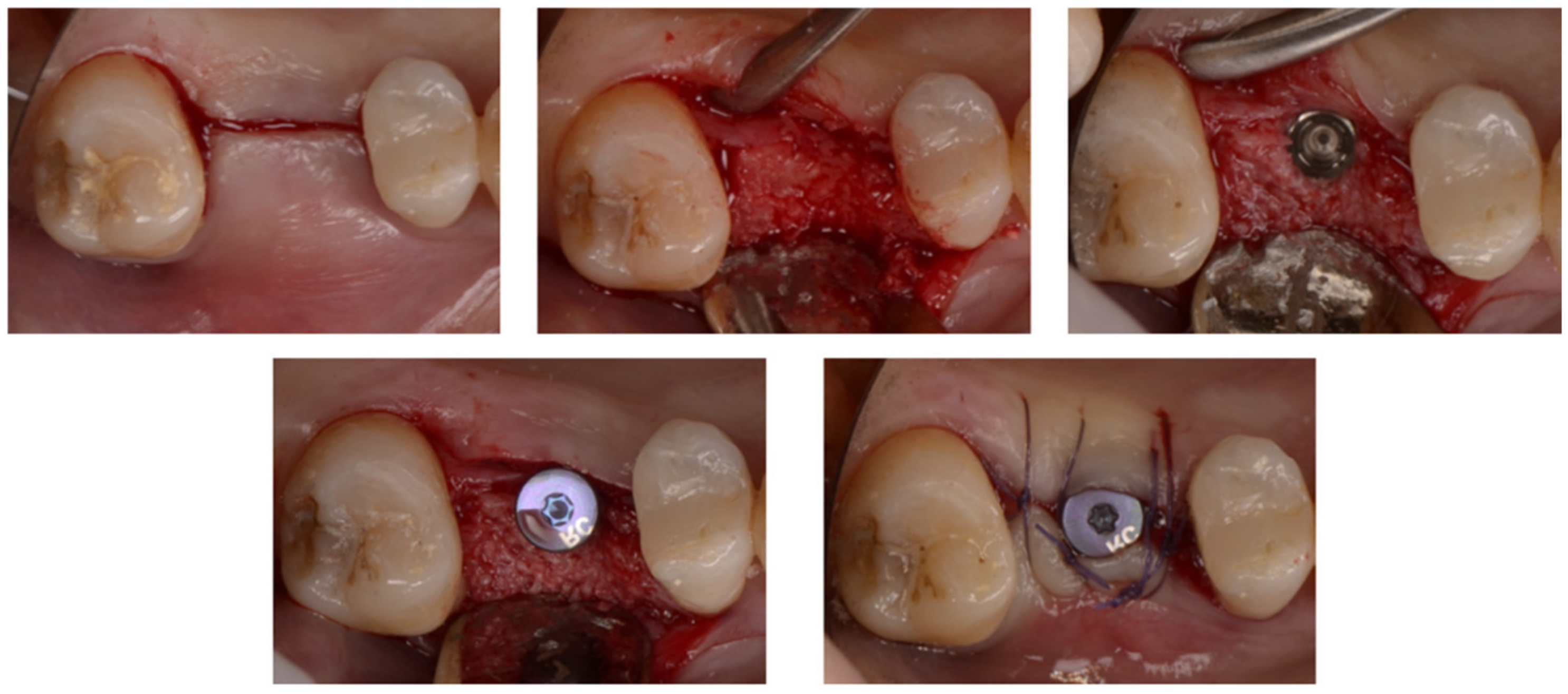 Applsci 12 11247 g010