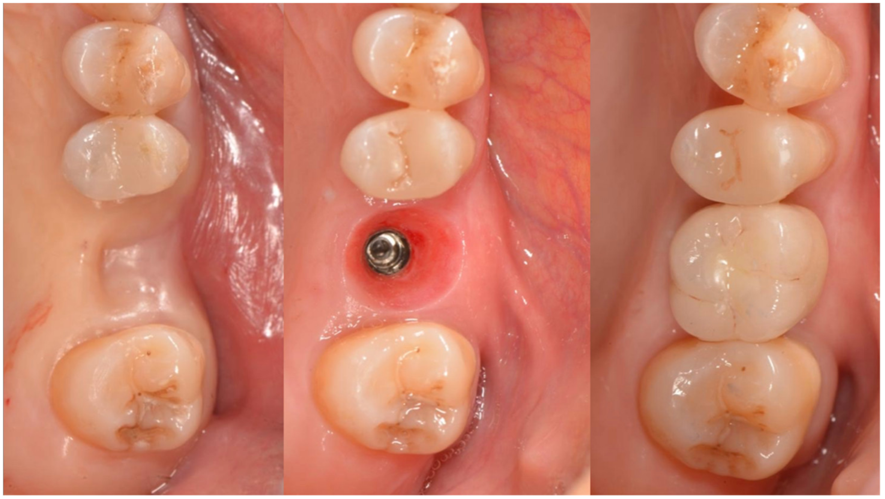 Applsci 12 11247 g011